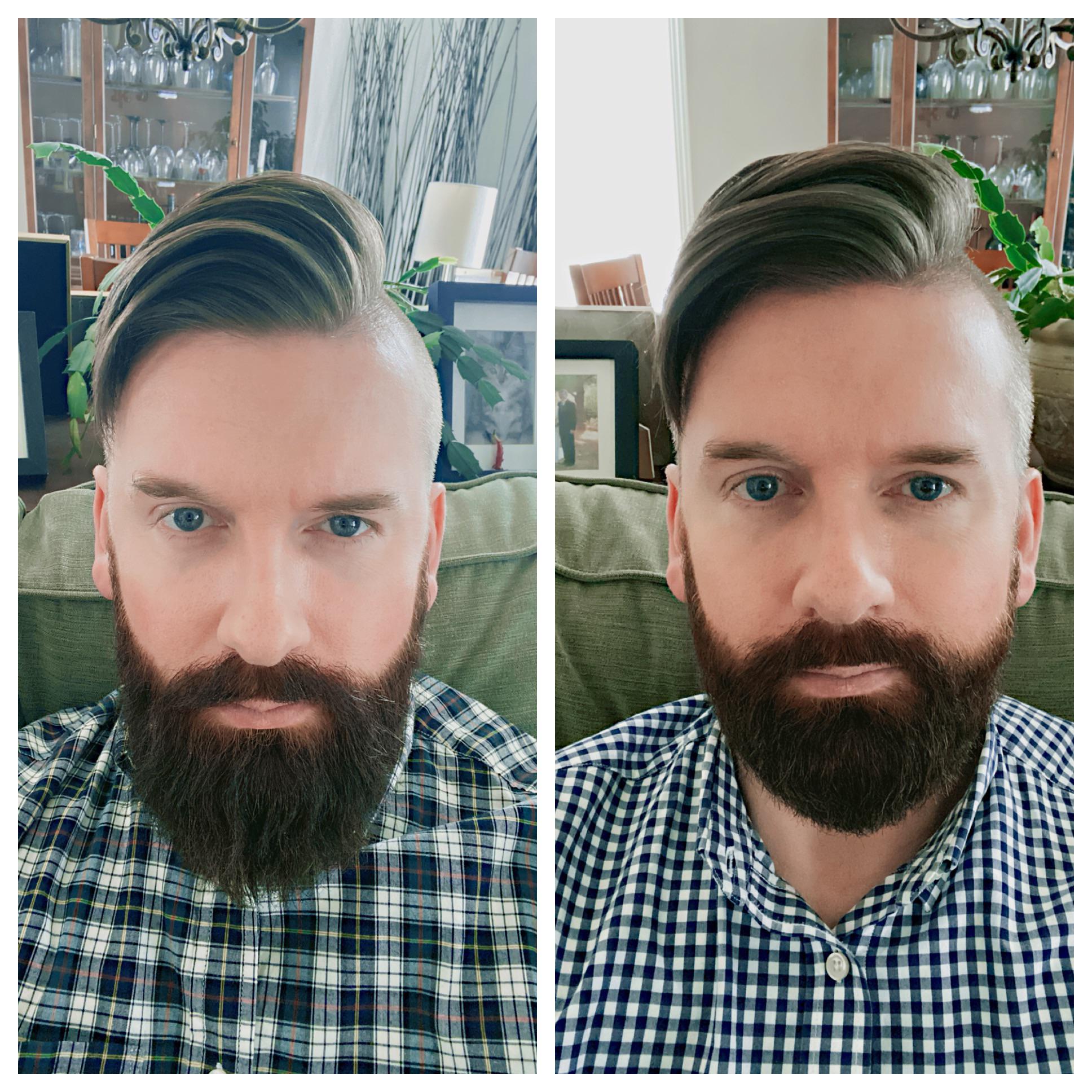 Did a significant trim. Kind of sad, but happy my beard still seems