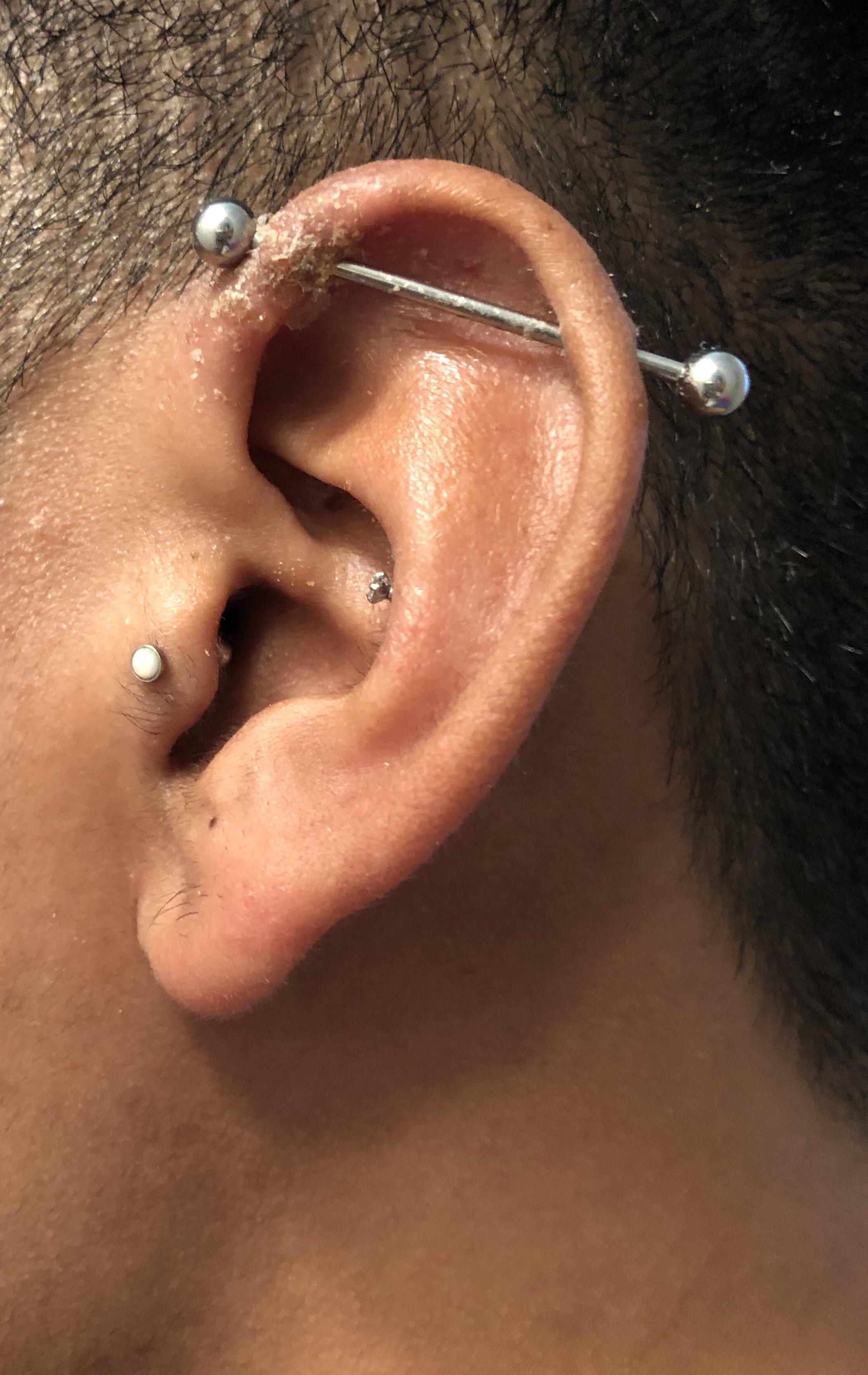 Industrial Piercings Infected