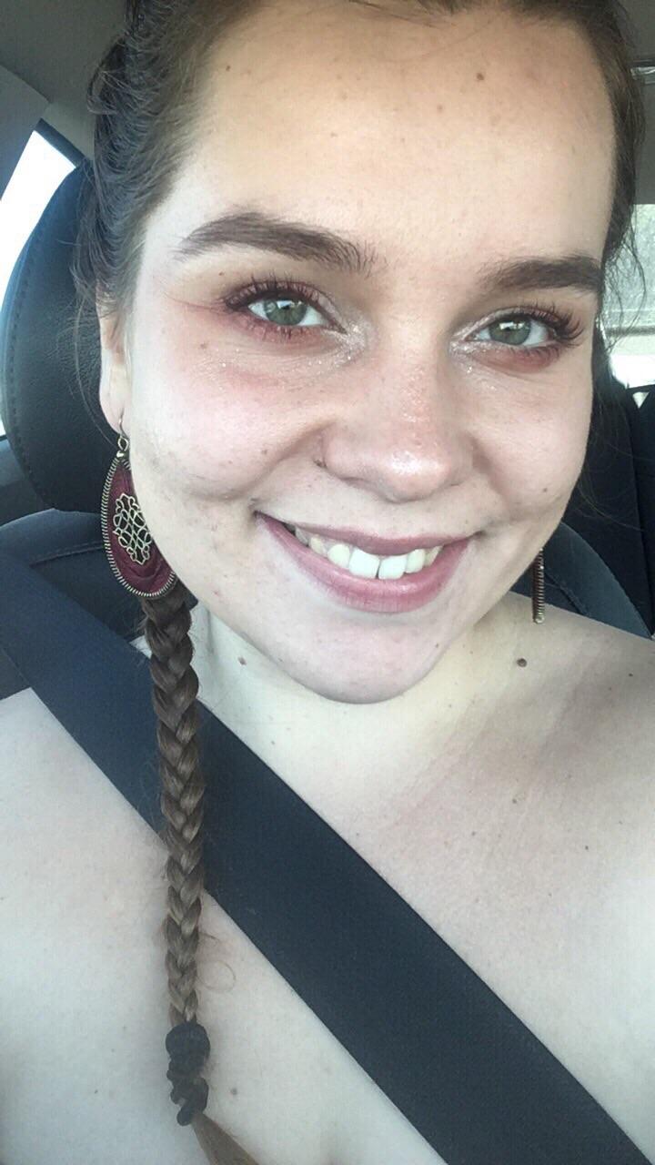 [AntiAging] help!! Premature aging due to living in the sunshine state