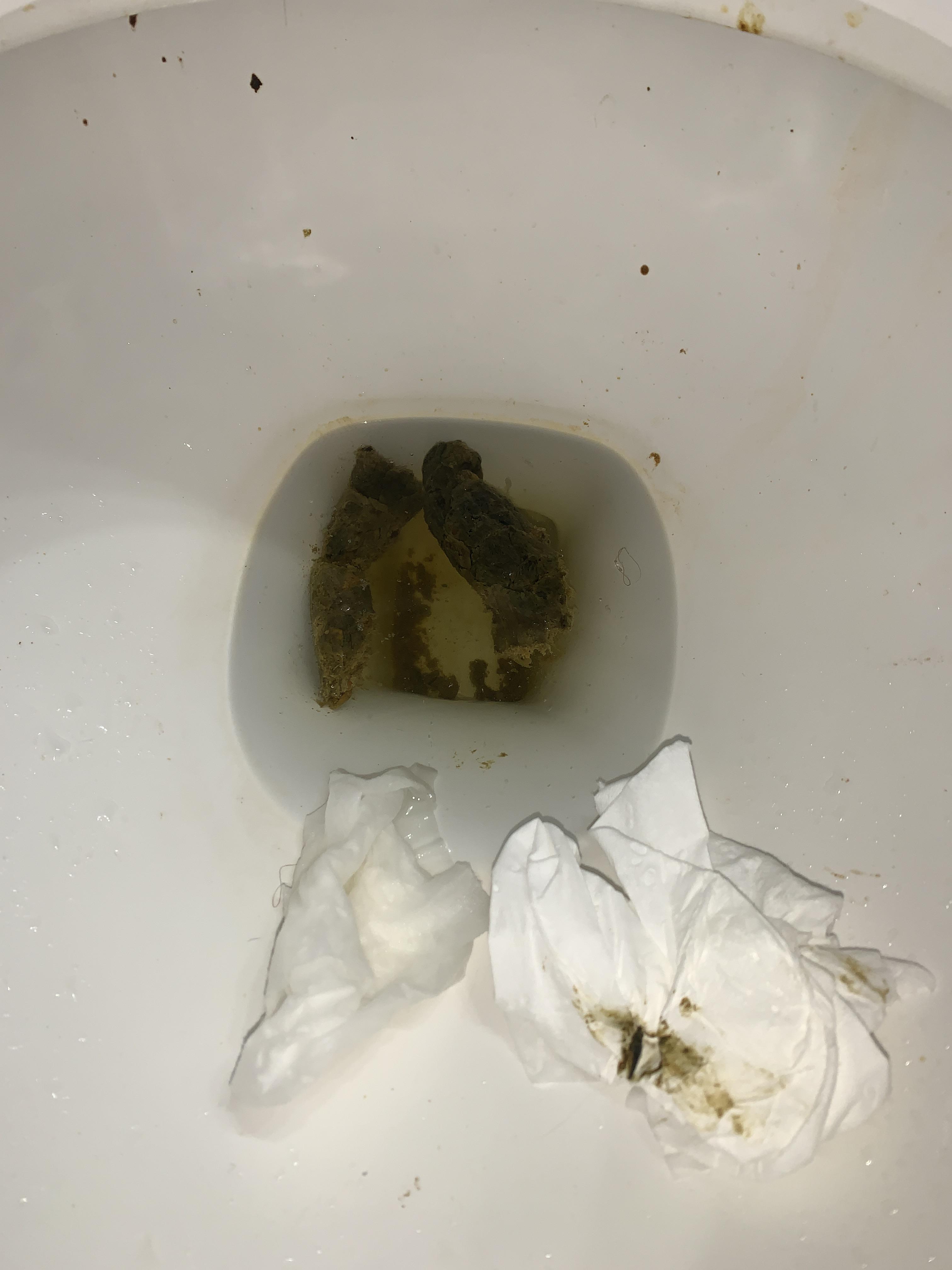 Is this poop normal? It’s like a blackish/green and it is the second of the day to look like