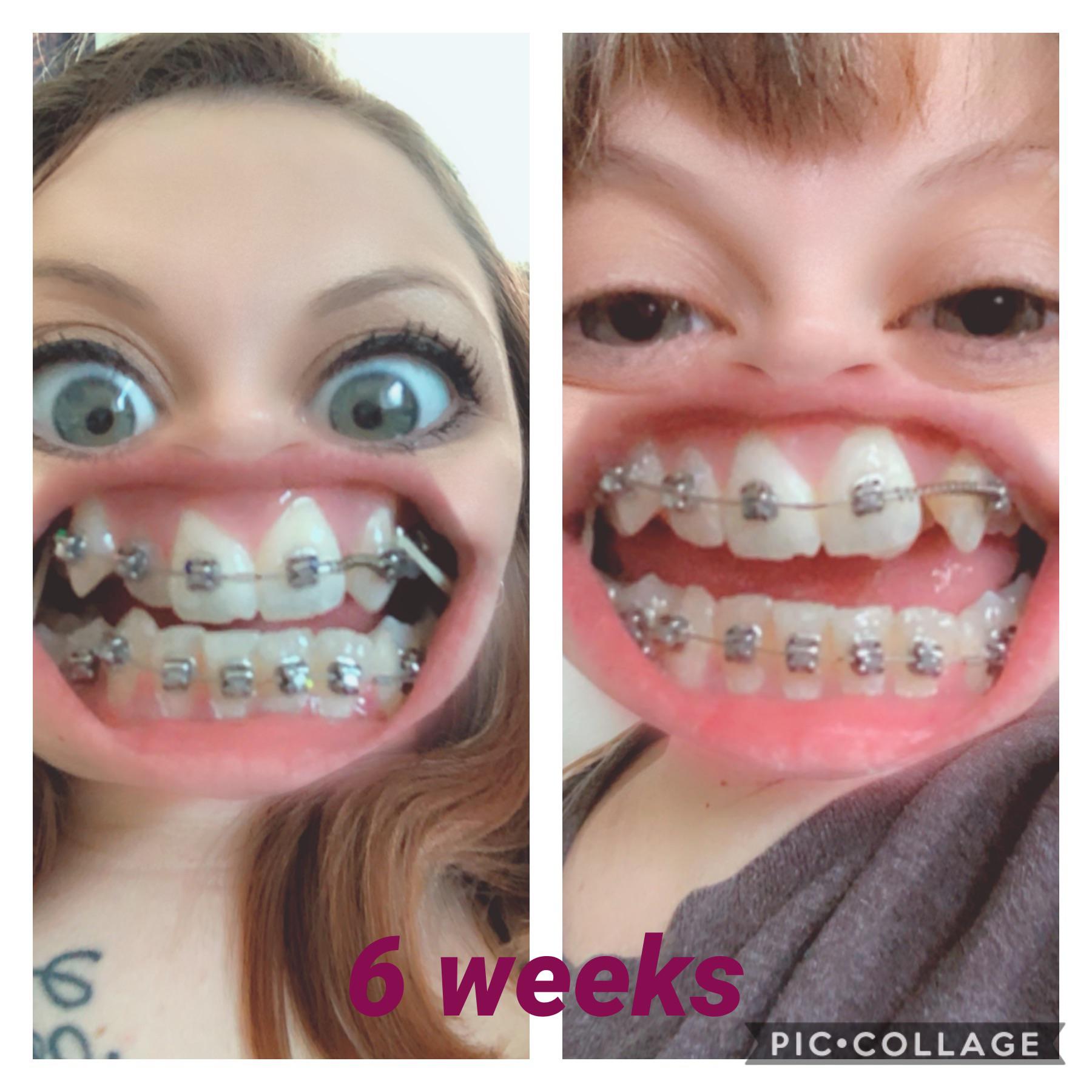 6 weeks progress. Not a whole lot but that spring is putting in WORK. I