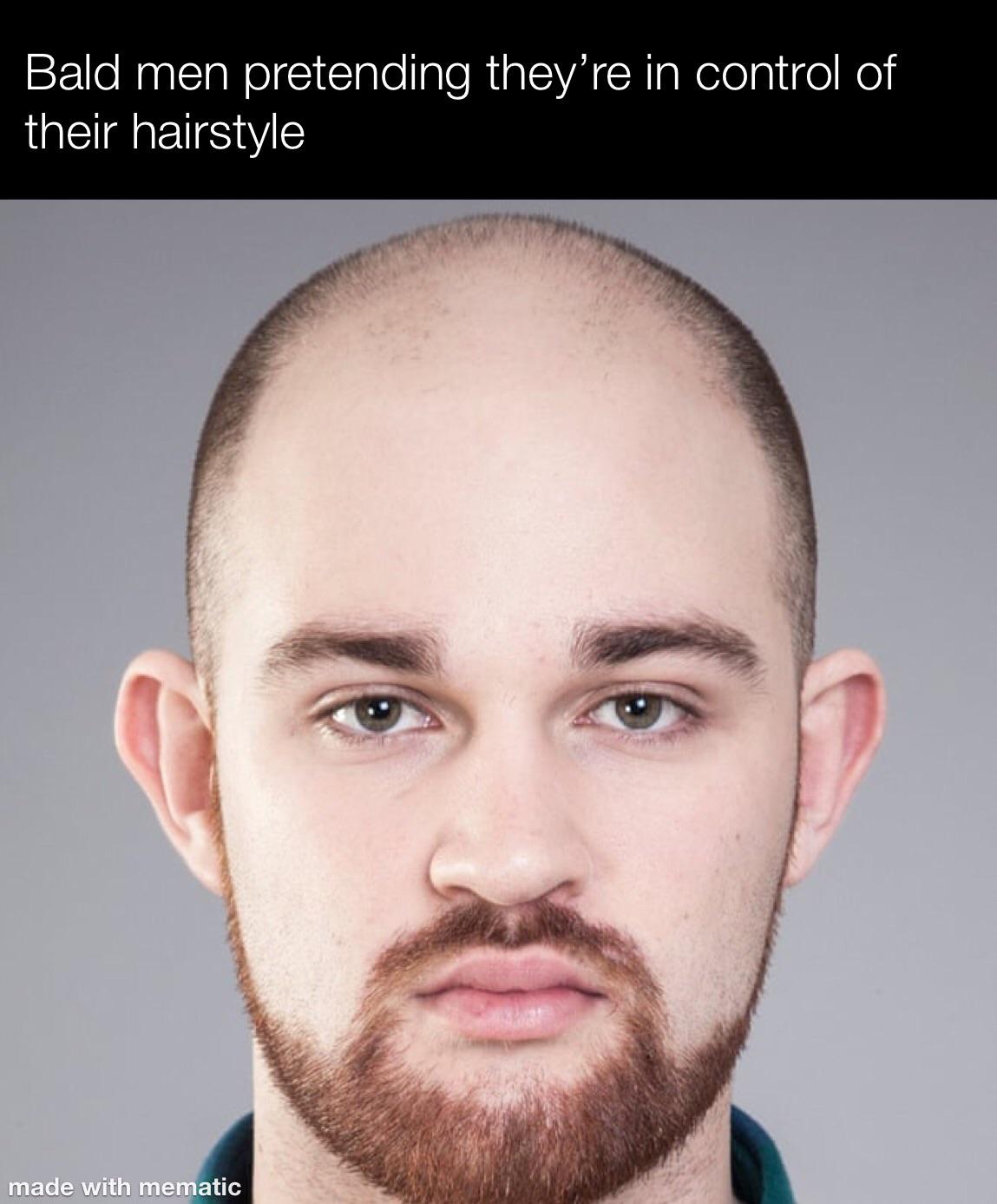 Aggregate 67+ hair loss meme best vova.edu.vn