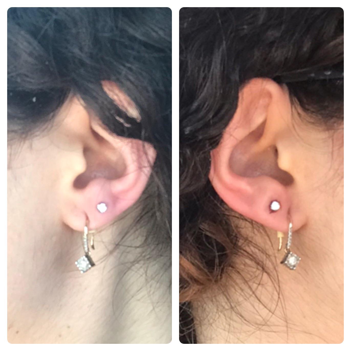 Got my doubles done today, but wondering if they look uneven. My ears