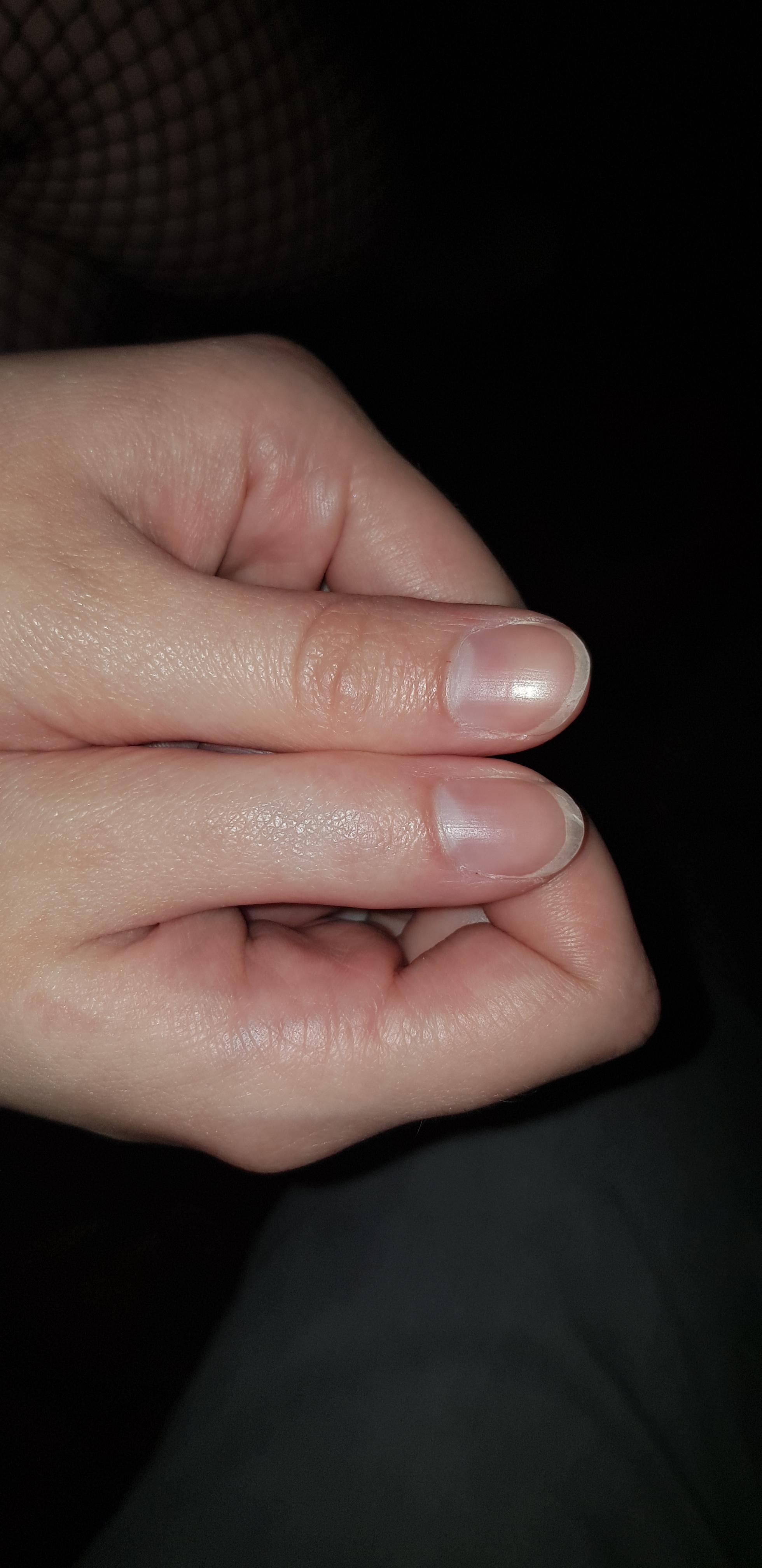 r/mildlyinteresting Posted by u/The_Invader_Kilz 3 years ago