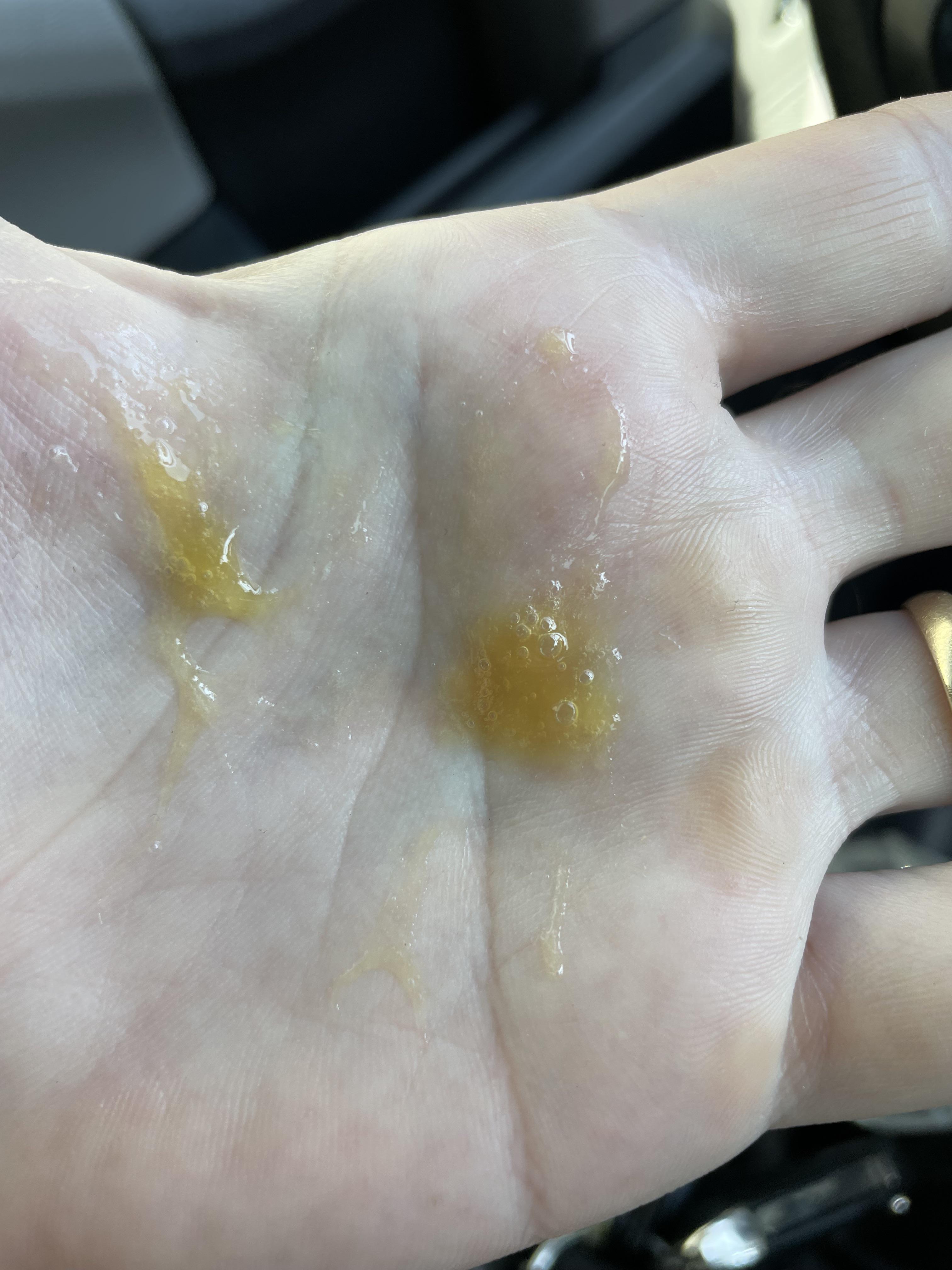 Orangeish mucus r/AskDoctorSmeeee