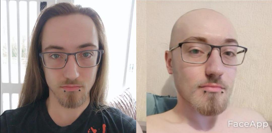 I'm probably going to start losing my hair in the next few years so I