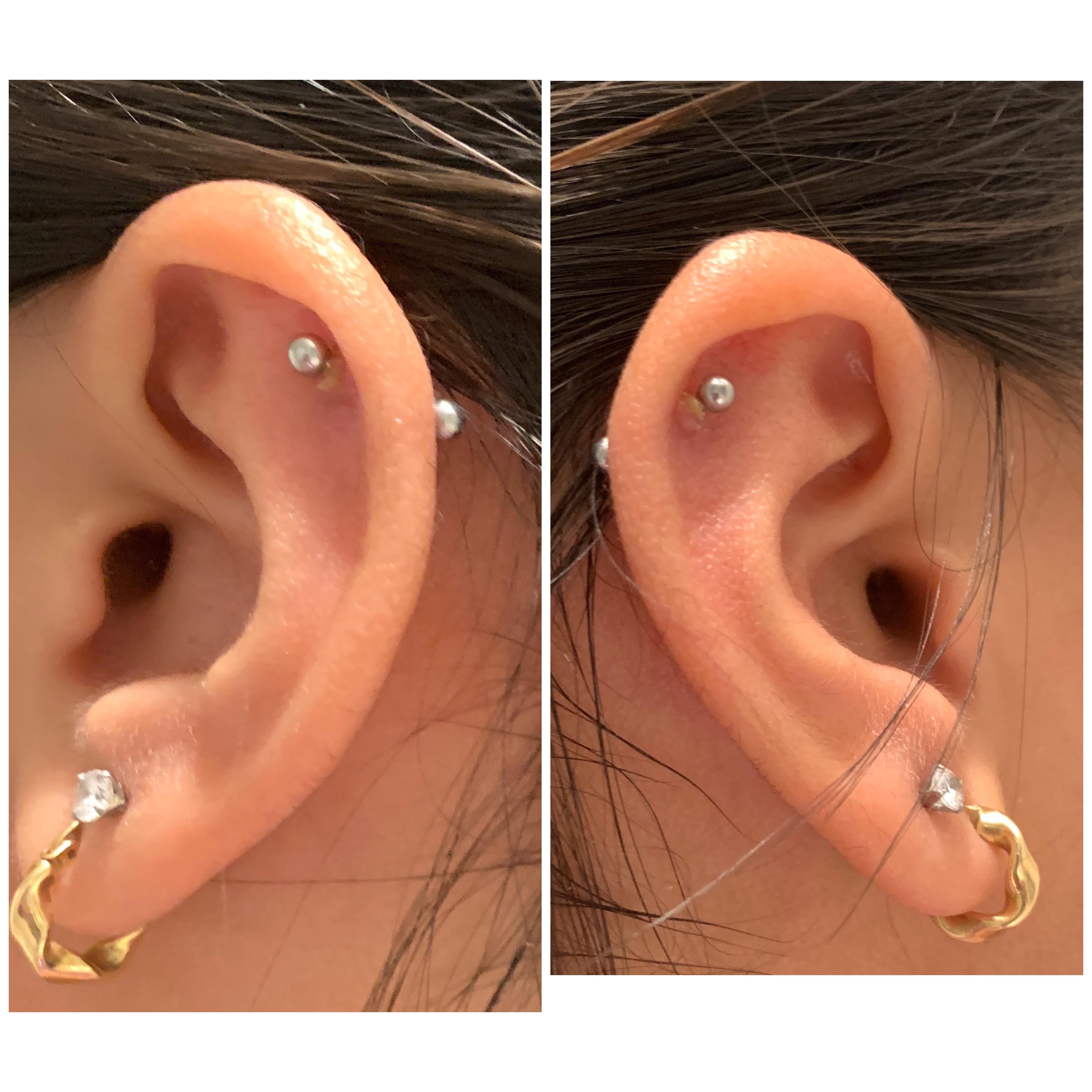 very crooked helix piercings! would it be possible for me to get them
