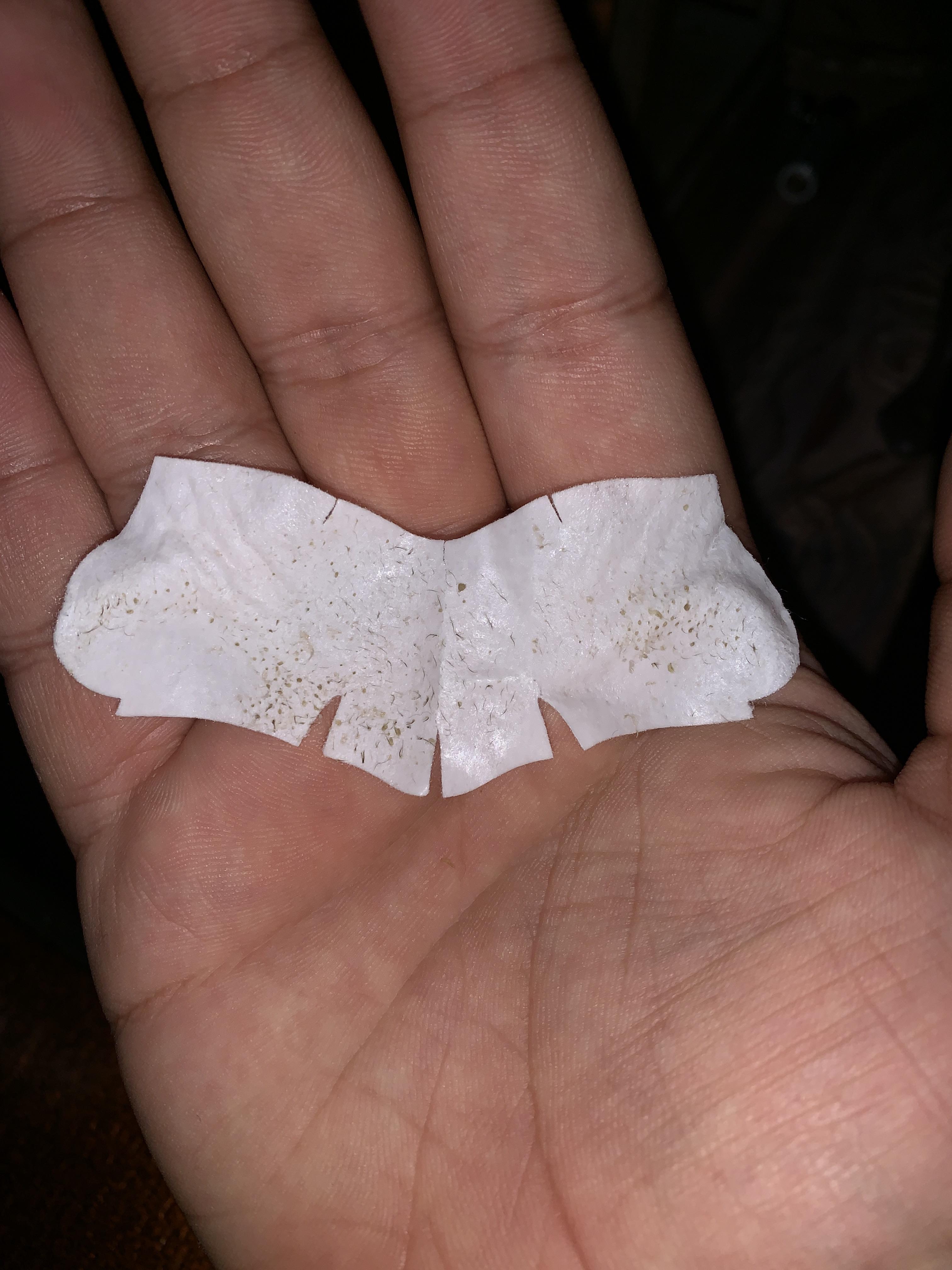 I know pore strips are bad for my skin but it was just too oily to resist r/popping