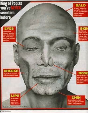 Michael Jackson Autopsy Photo Rdafuqbro