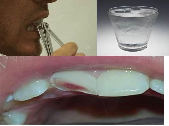 Thanks, I hate it Teeth and cold water. TIHI