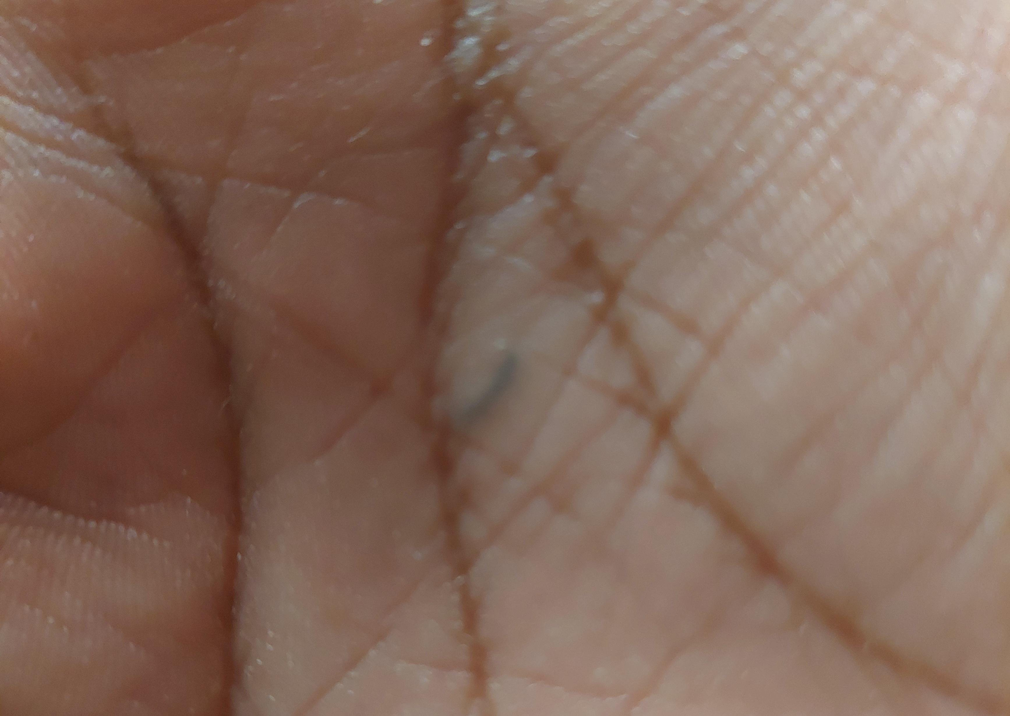 That's ink. A pen went inside the upper layer of skin and made a mark