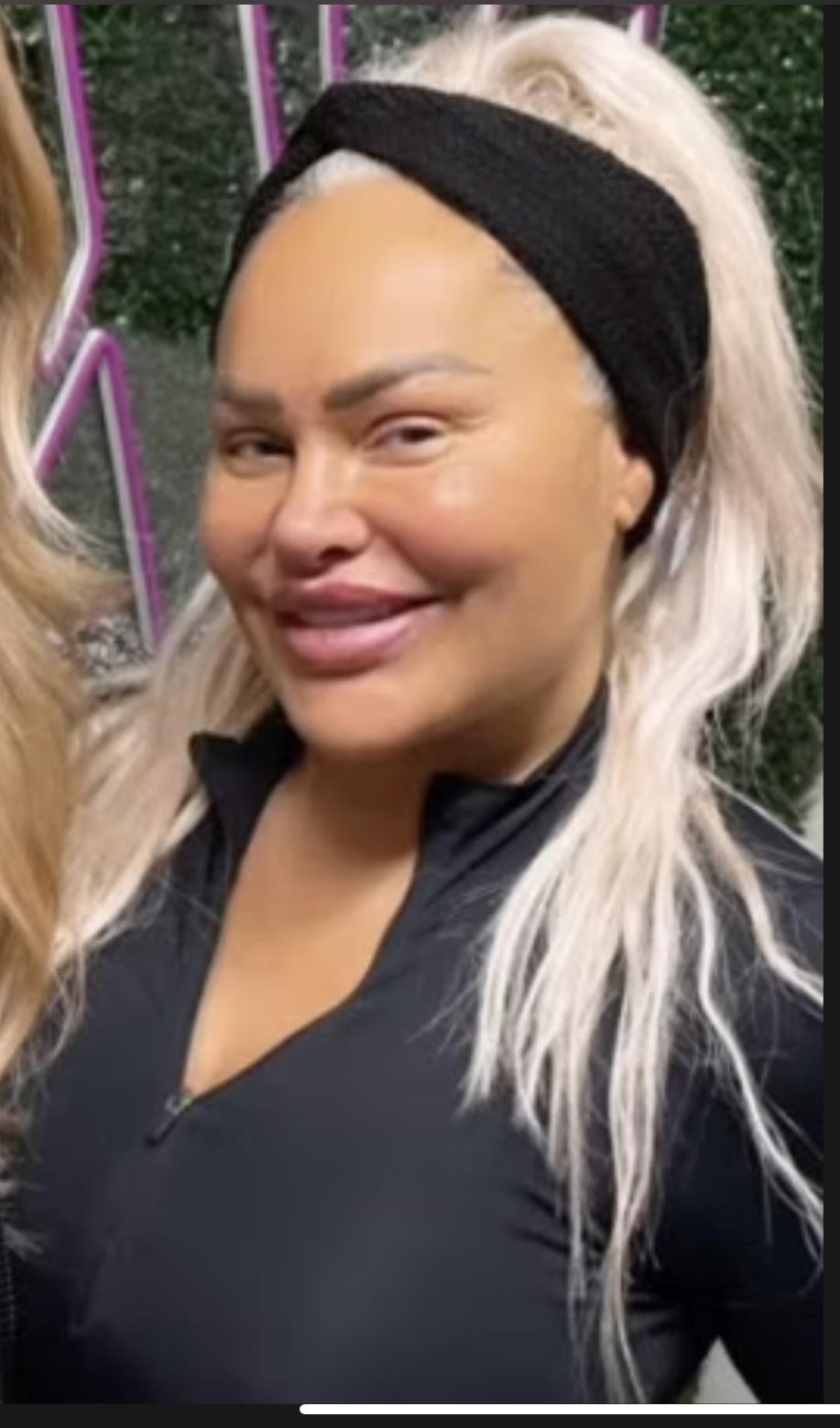 Darcey looks horrifying. This is a photo I found was taken Dec. 22