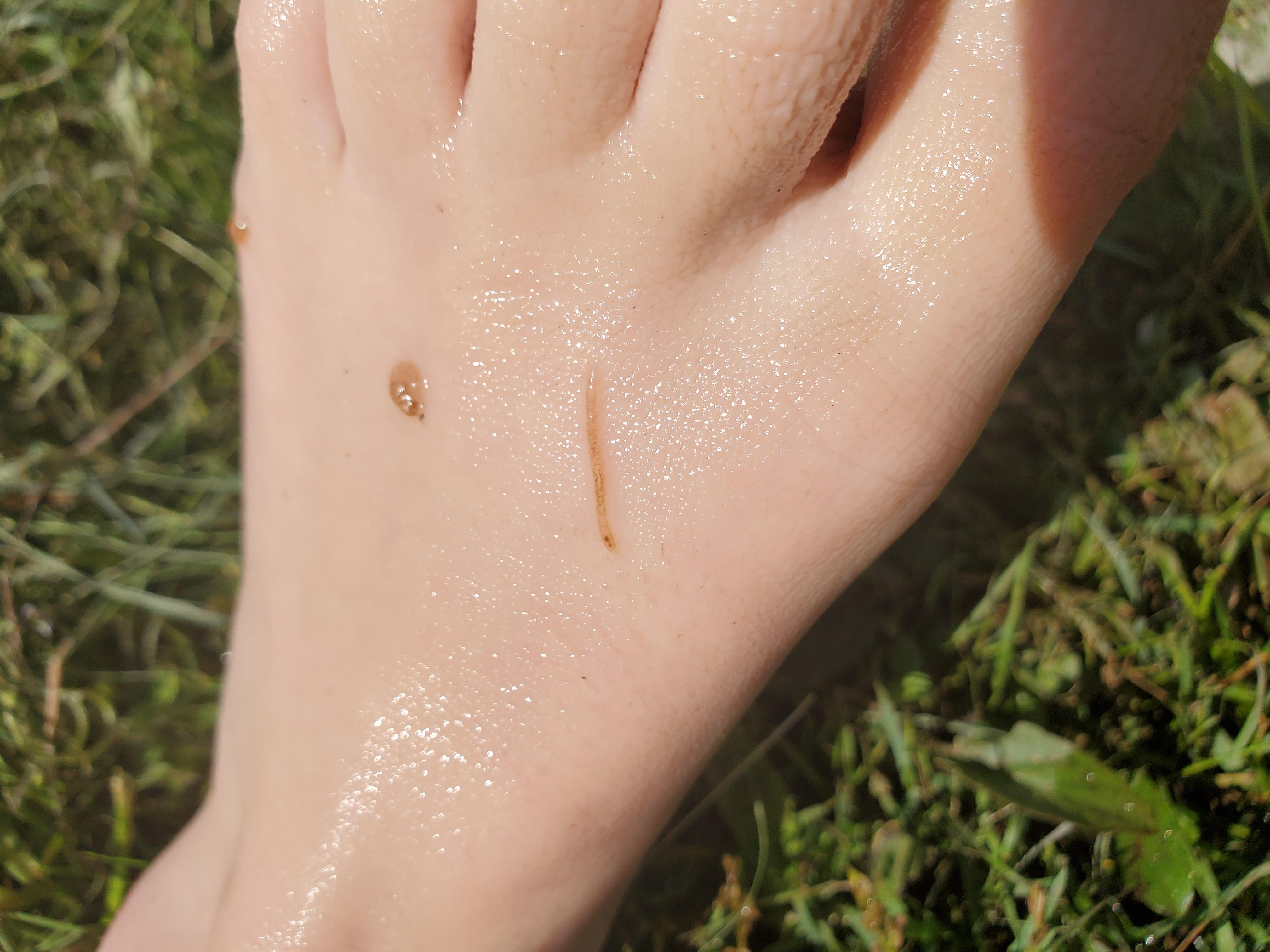 What is this worm? It attached while in lake water in northern ohio. It