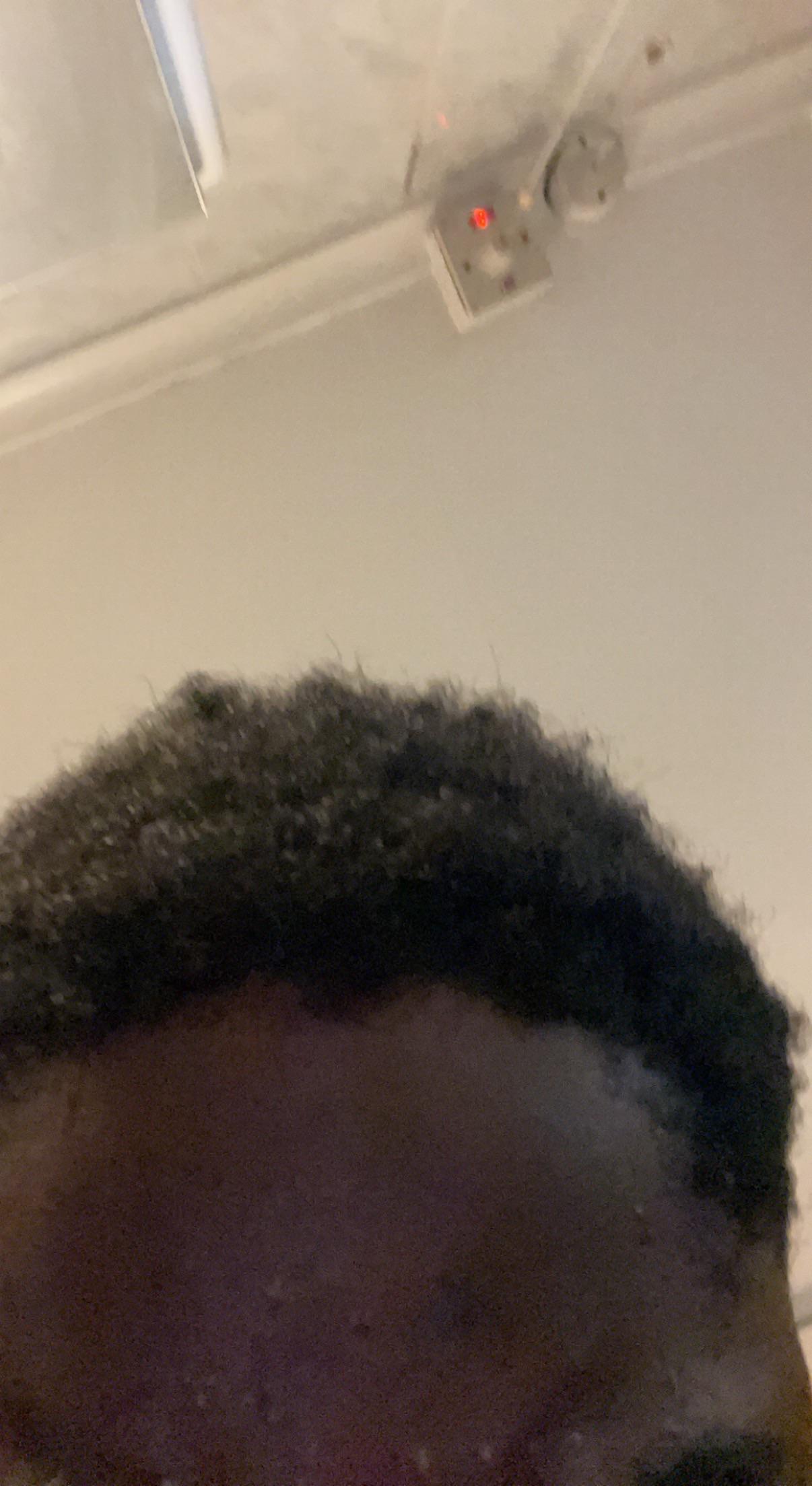 Anyone know why my hairline “bumpy” like dis r/BlackHair