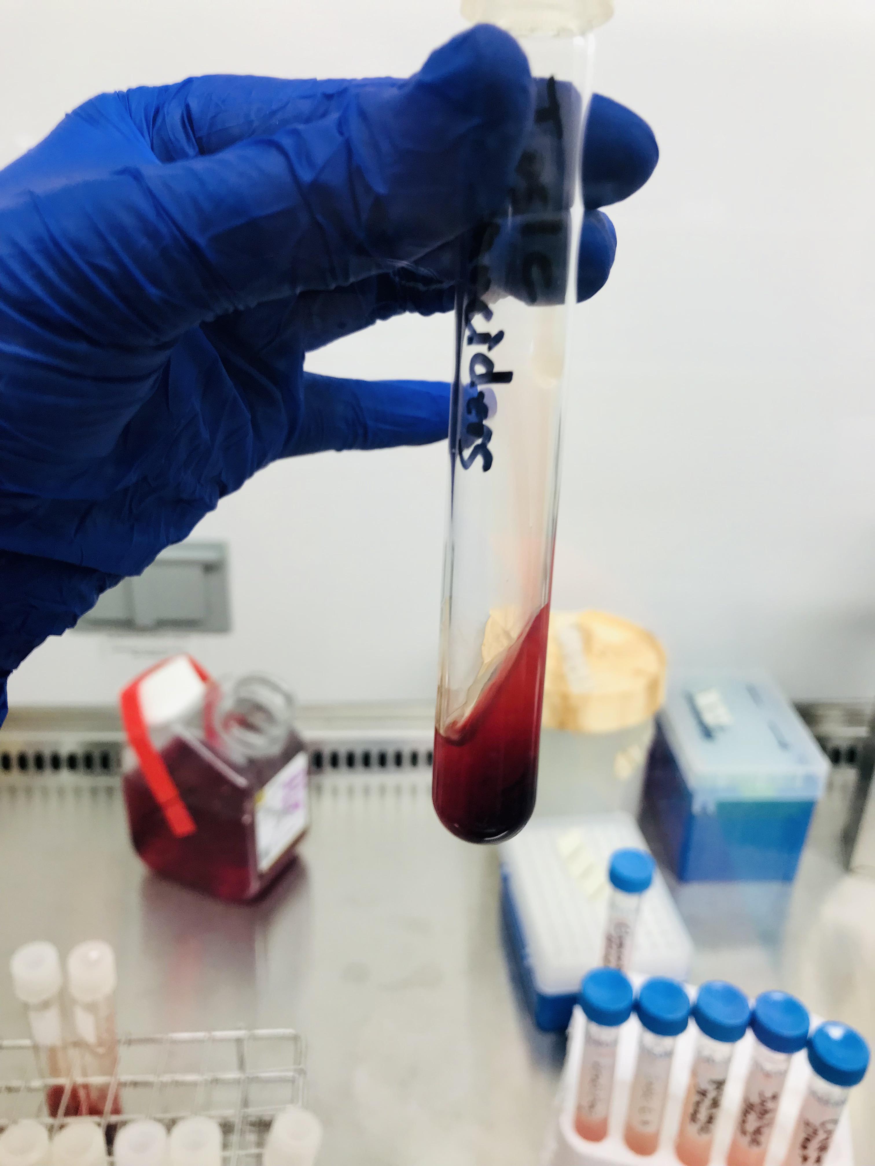 Cherry JellO shots? Or blood agar? r/labrats