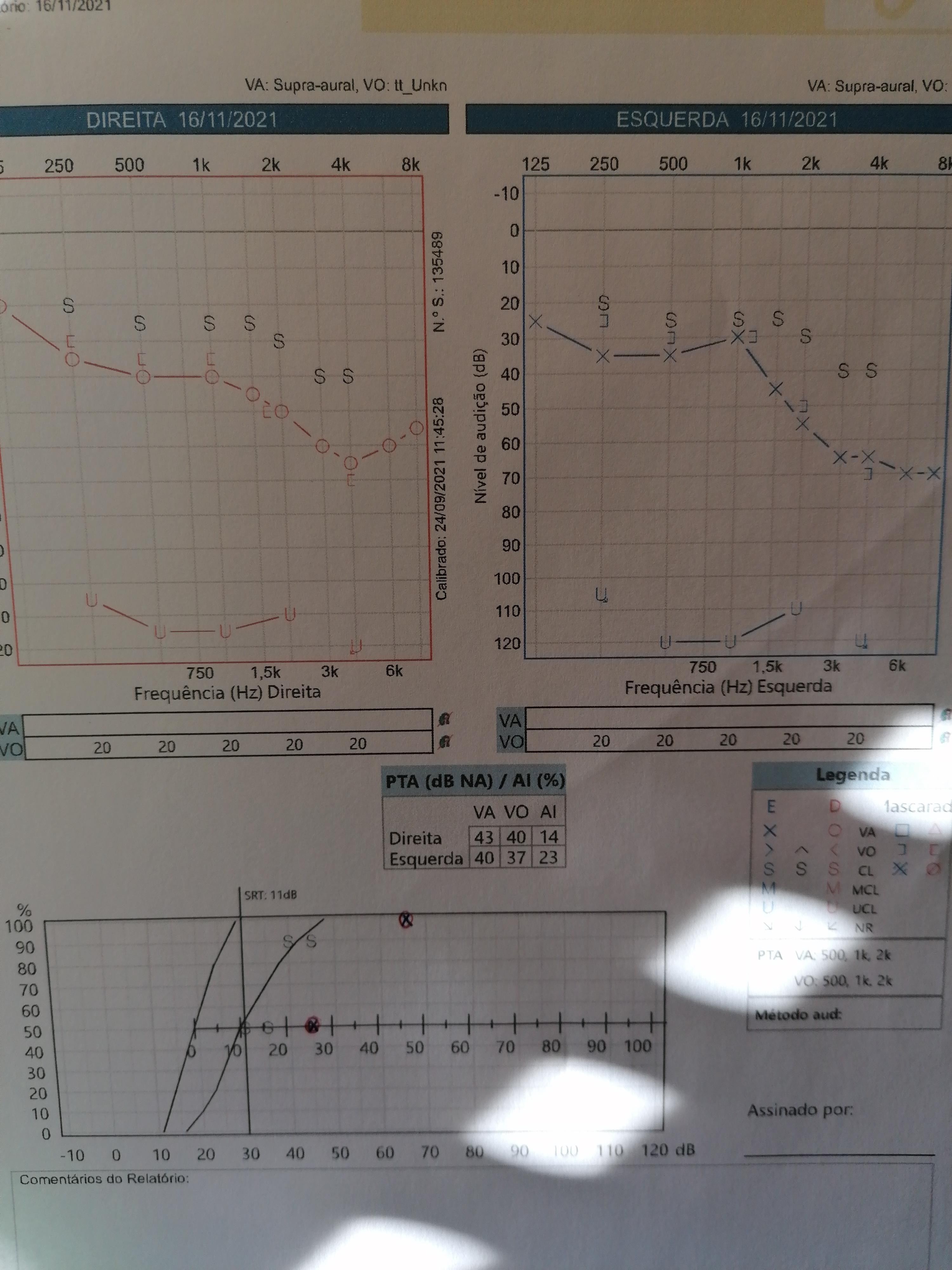 Hearing Aid Gain. Is this a good gain. How do you measure gain? Help a