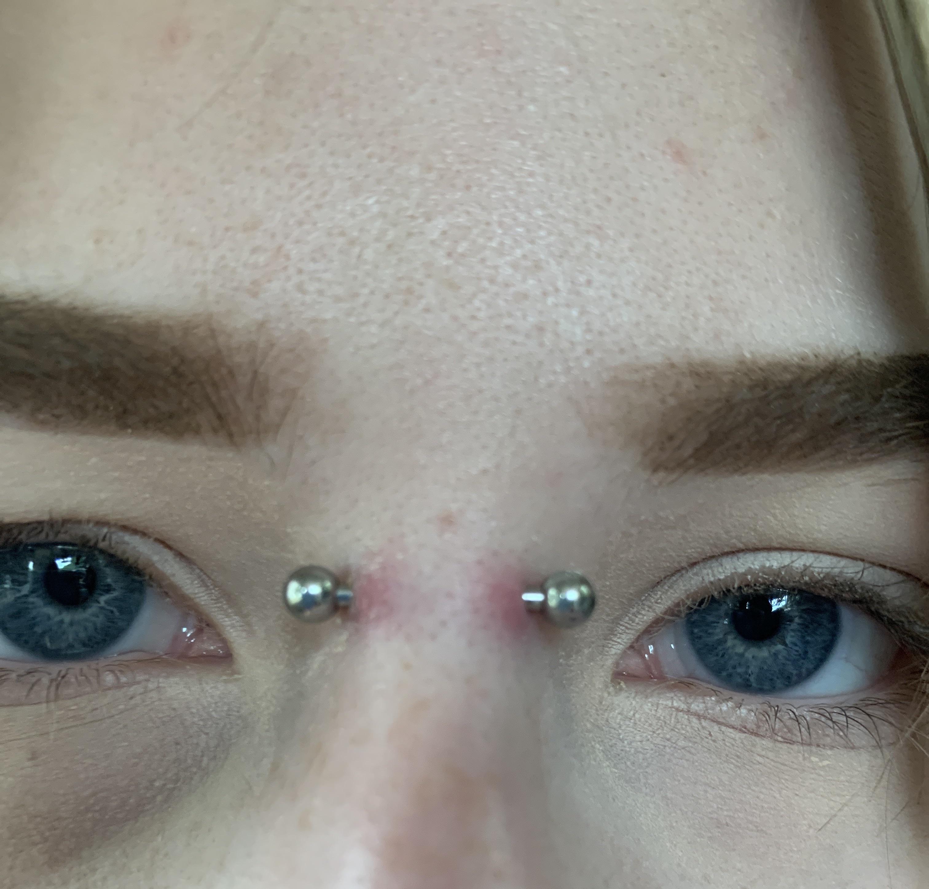 List 95+ Pictures Infected Nose Piercing Healing Process Pictures Completed