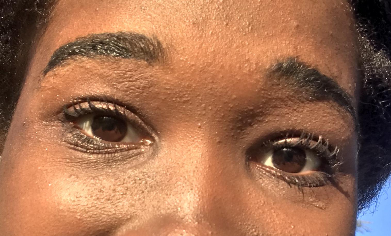 I need some advice on my skin. Under my eyebrows the skin has