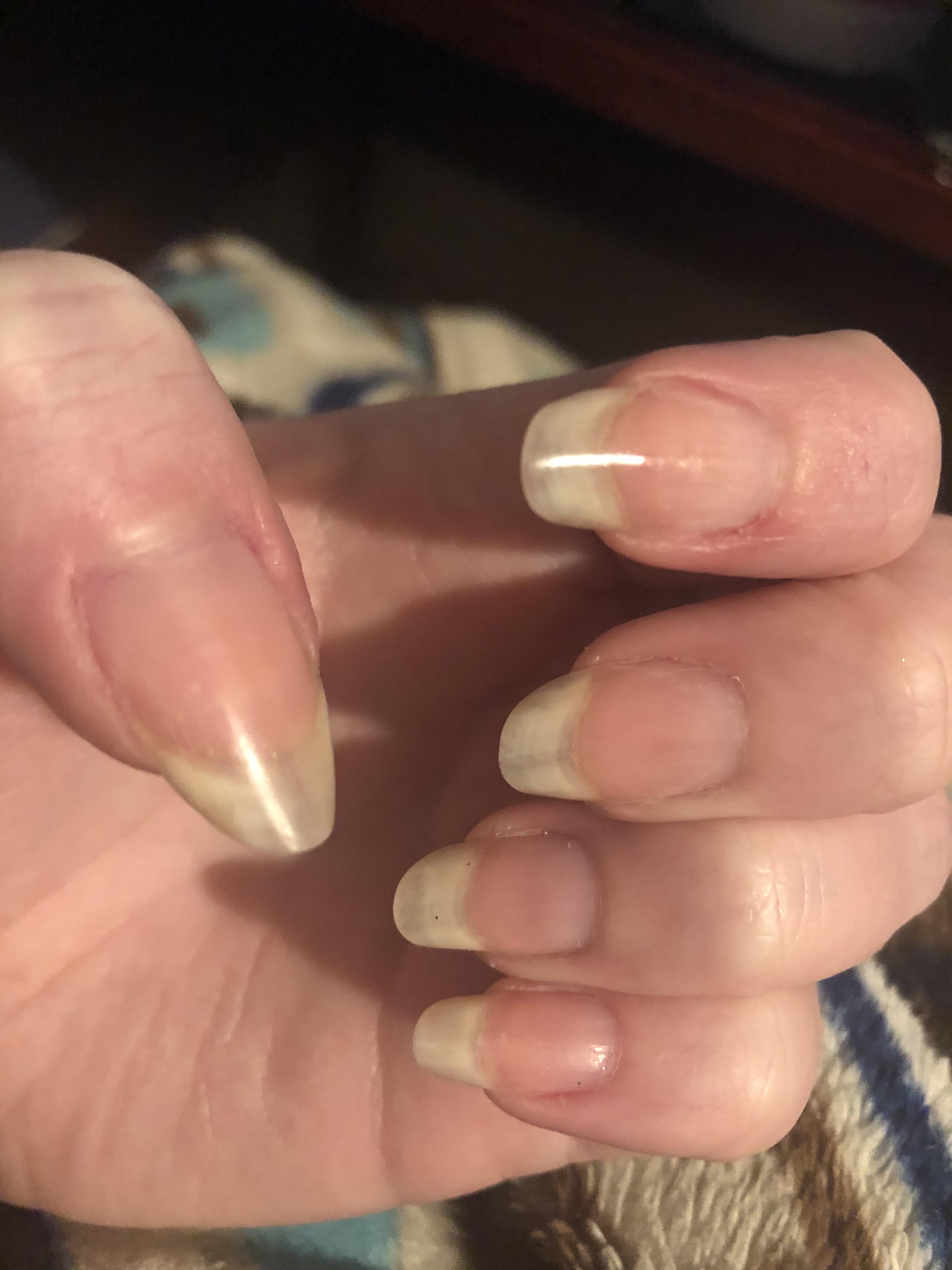 Nail beds are weird from years of biting but this is the longest and