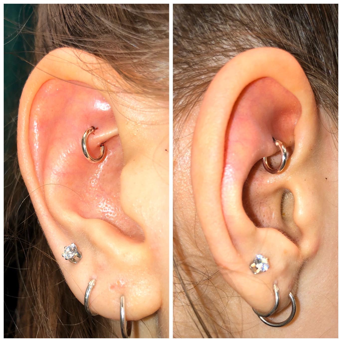 Is my rook piercing too shallow? I could totally live with the way it