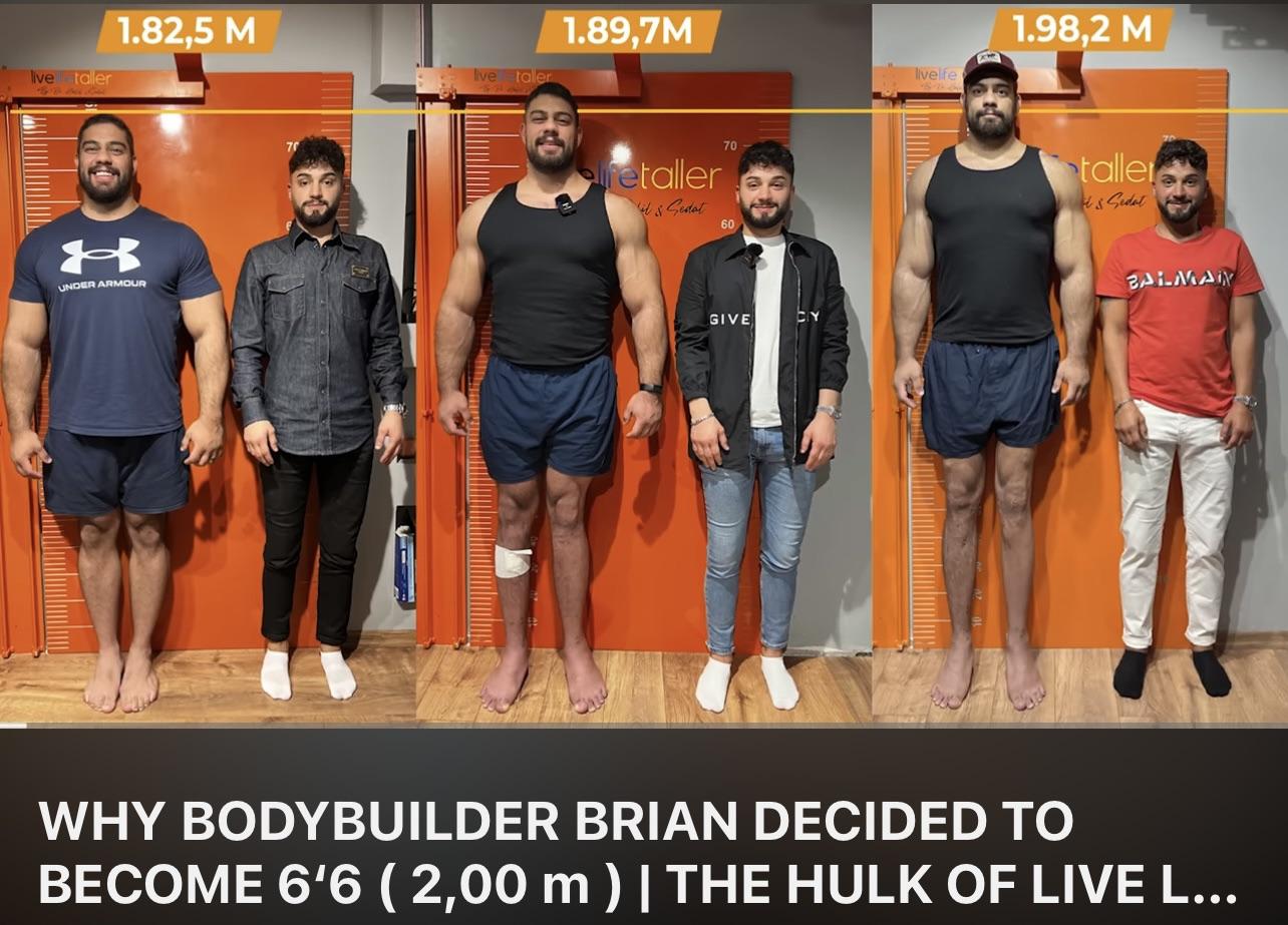 Limb lengthening surgery 5’11 to 6’6 r/tall