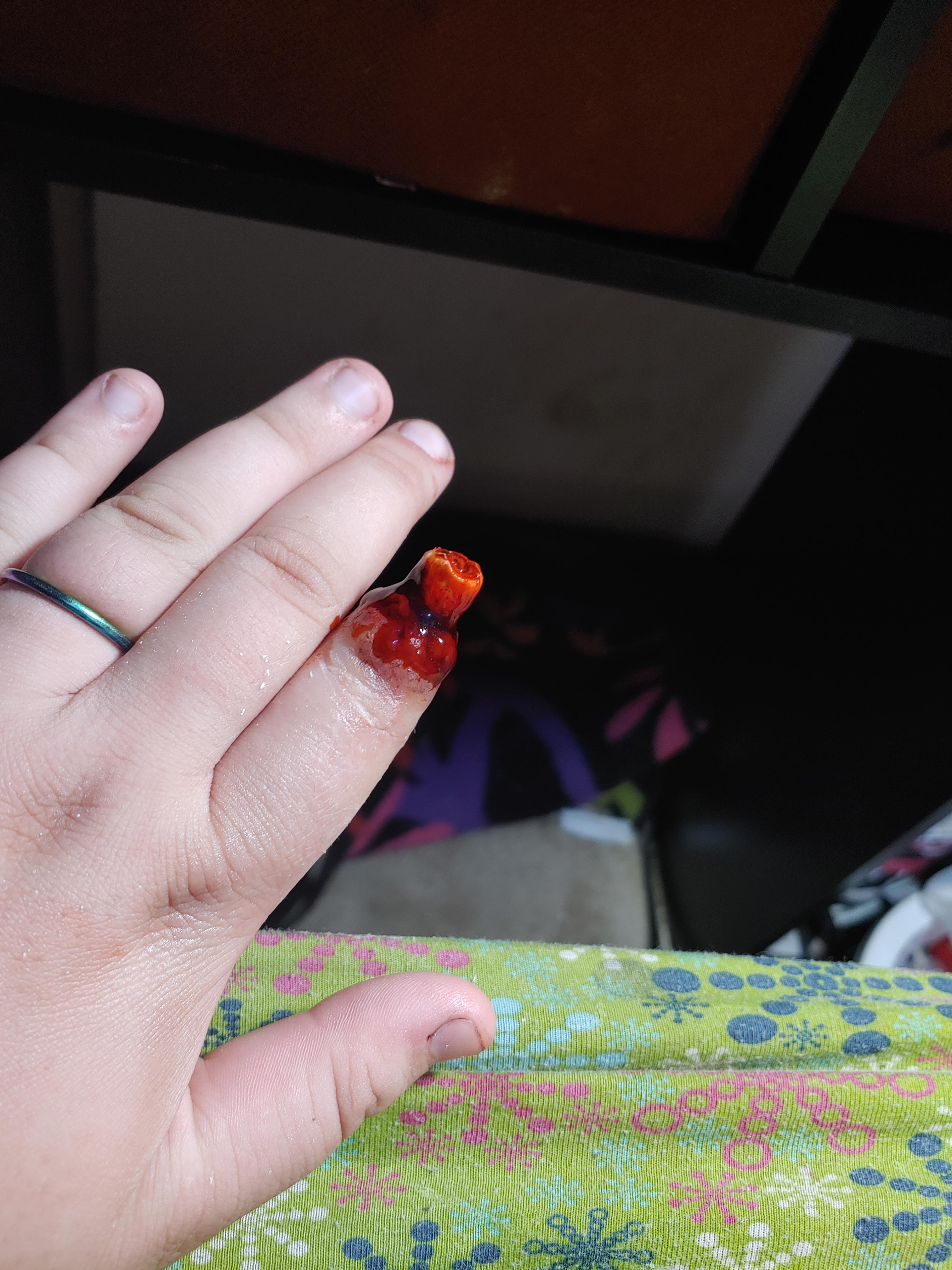 First try at ripped off/cut off finger r/sfx