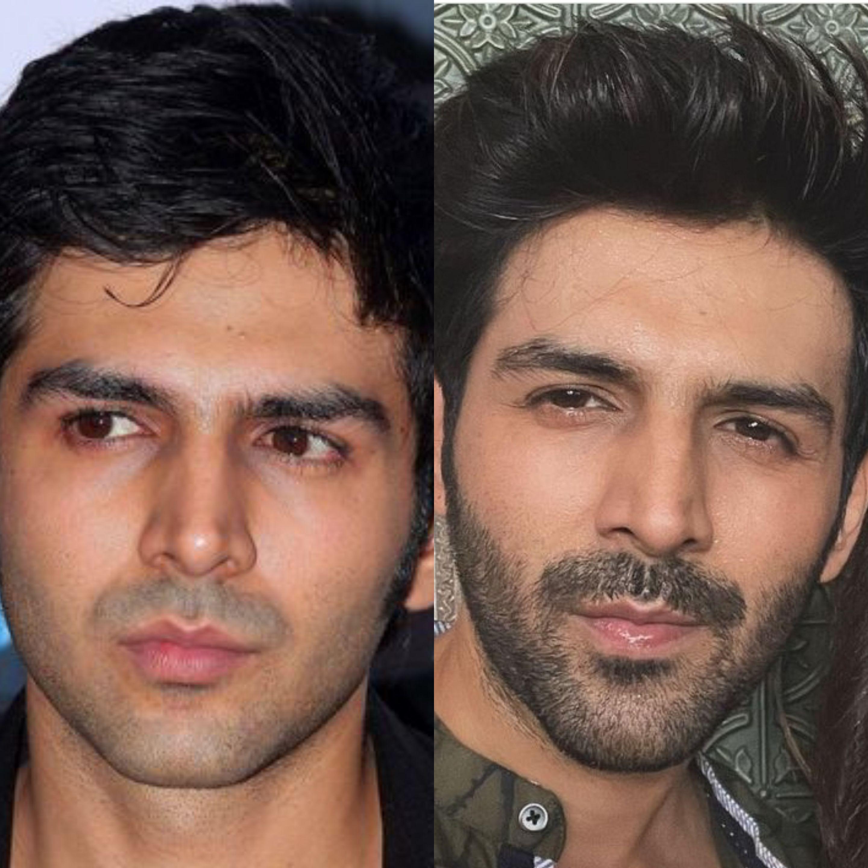 Bollywood Male Actors Hair Transplant And Plastic Surgery : R/Bollyblindsngossip