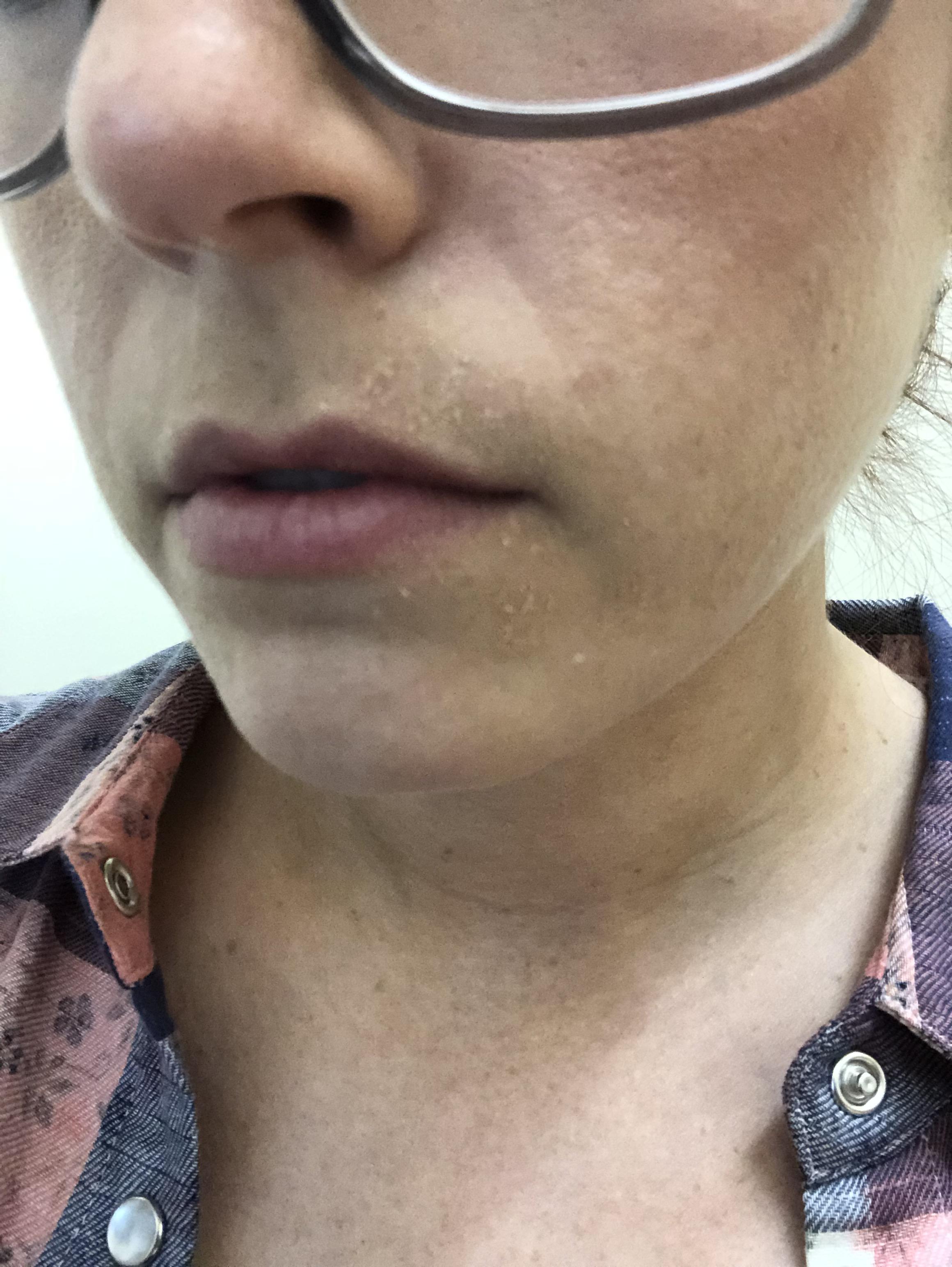 [skin concerns] is this an example of dehydrated skin? No matter what I