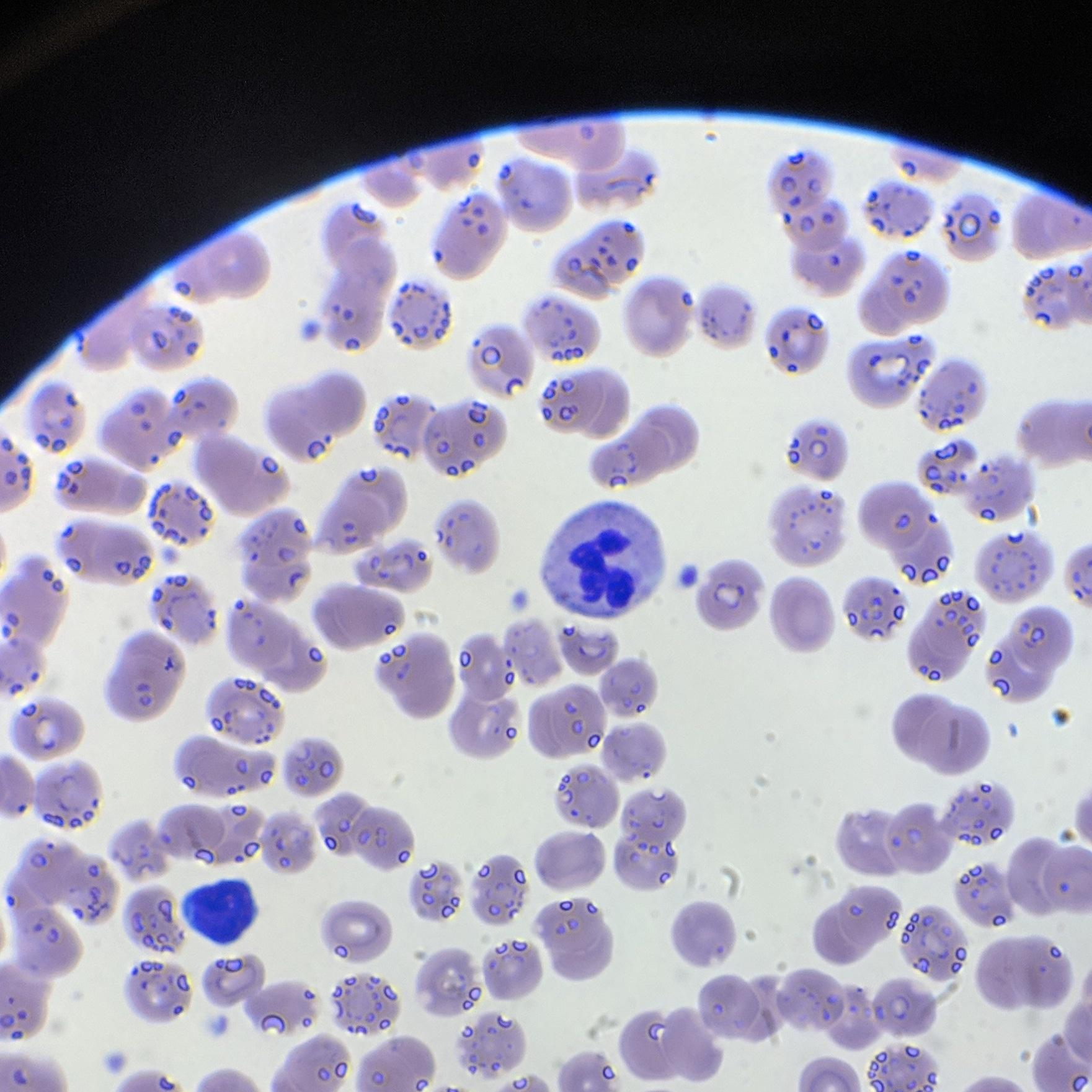 Found a bunny in this white blood cell. mildlyinteresting
