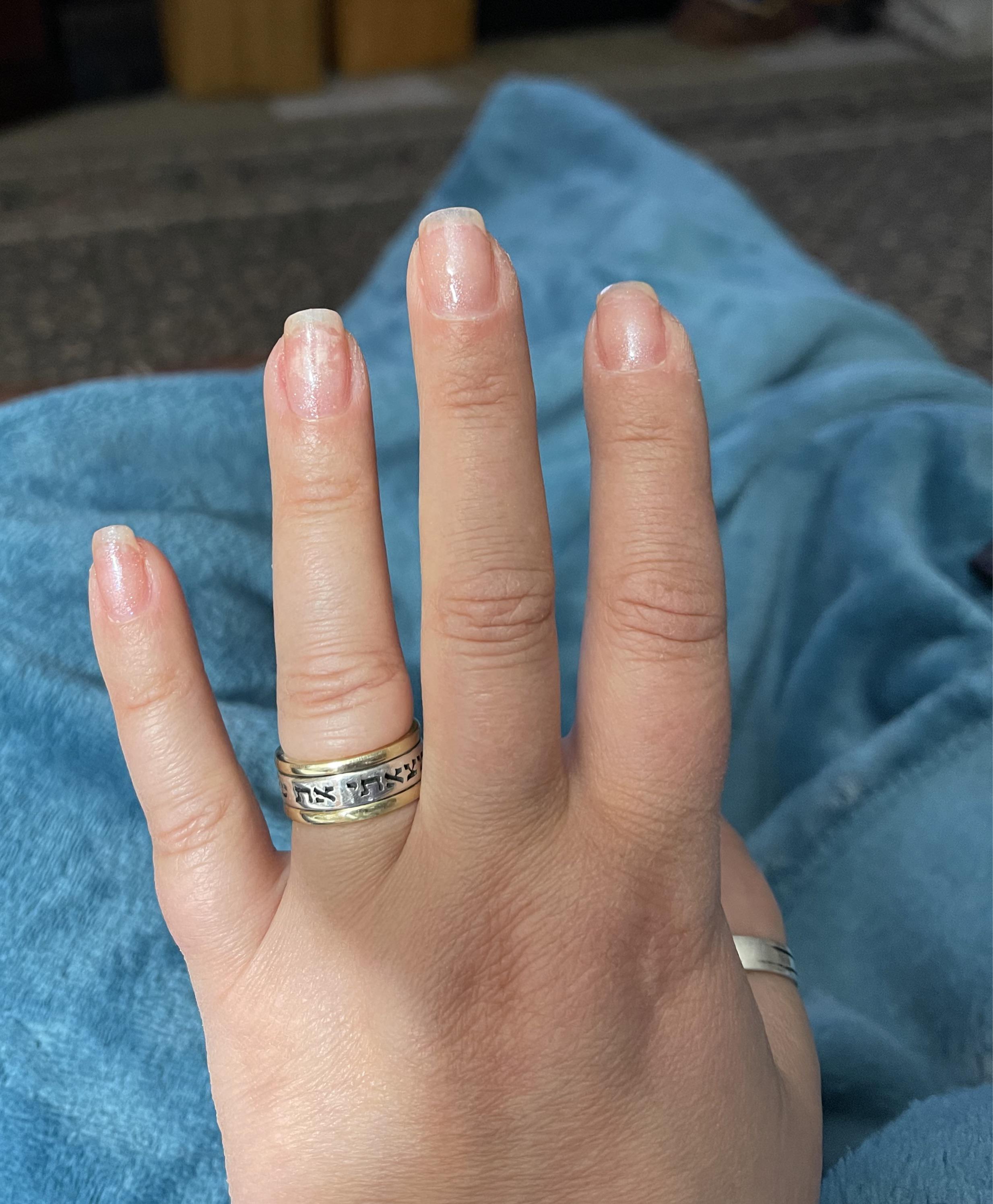 Does anyone know if I can wear this polish during surgery? It shouldn’t