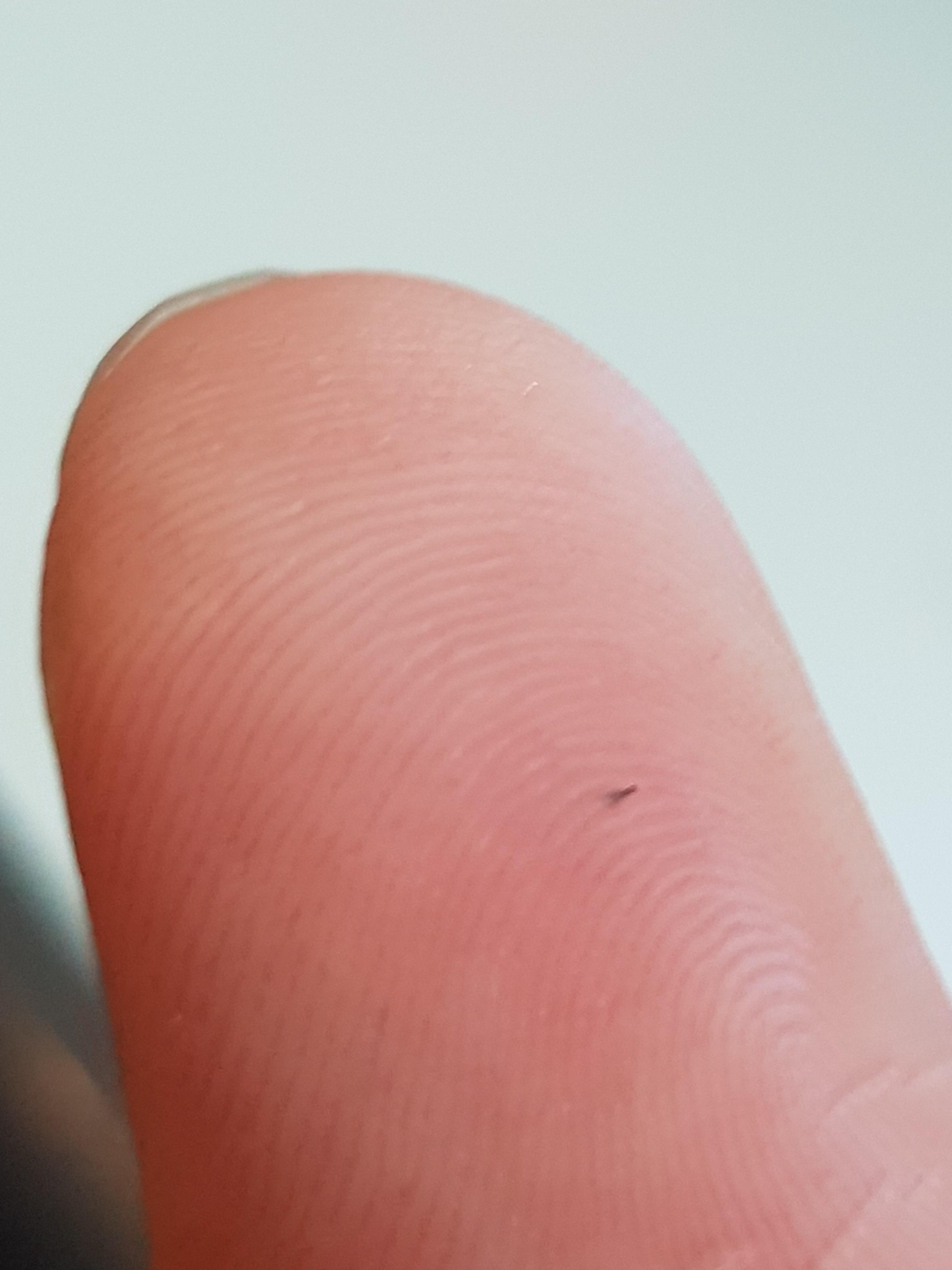 Dear popping community, is there another way to remover this thing from