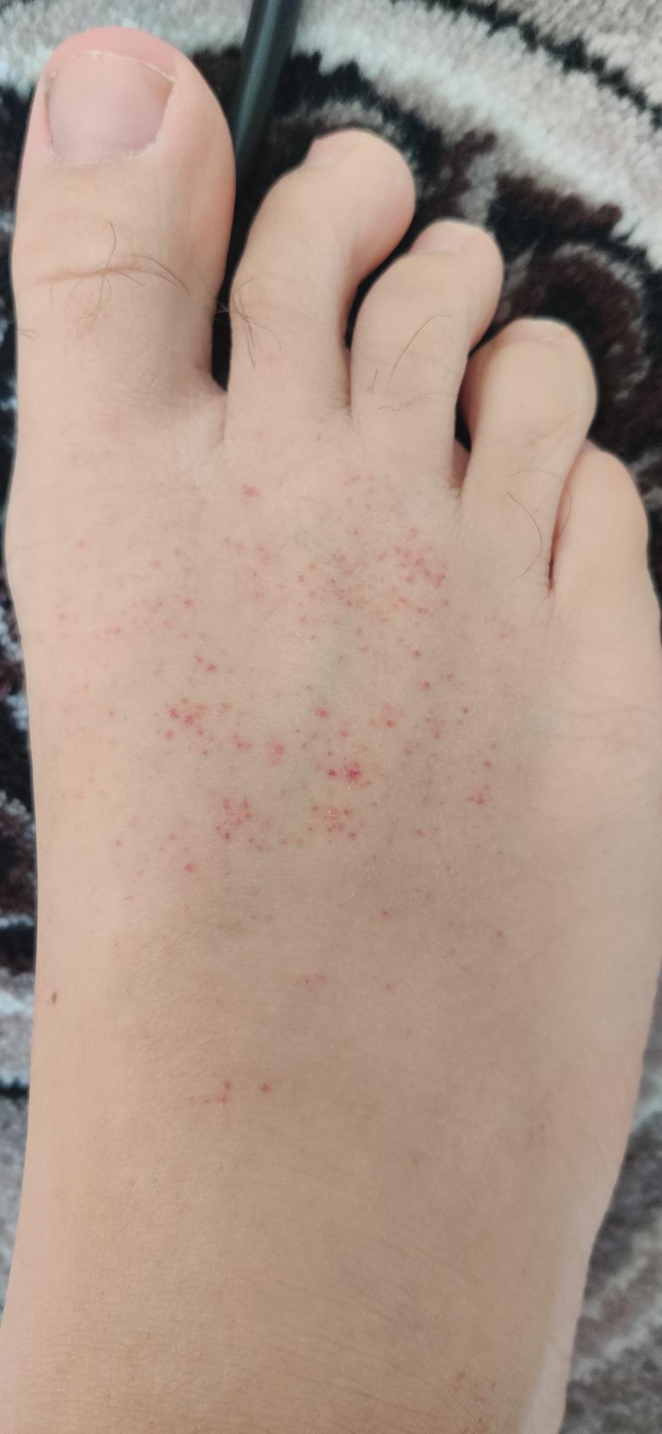 What could this be? Noticed after shower. I take hot long showers