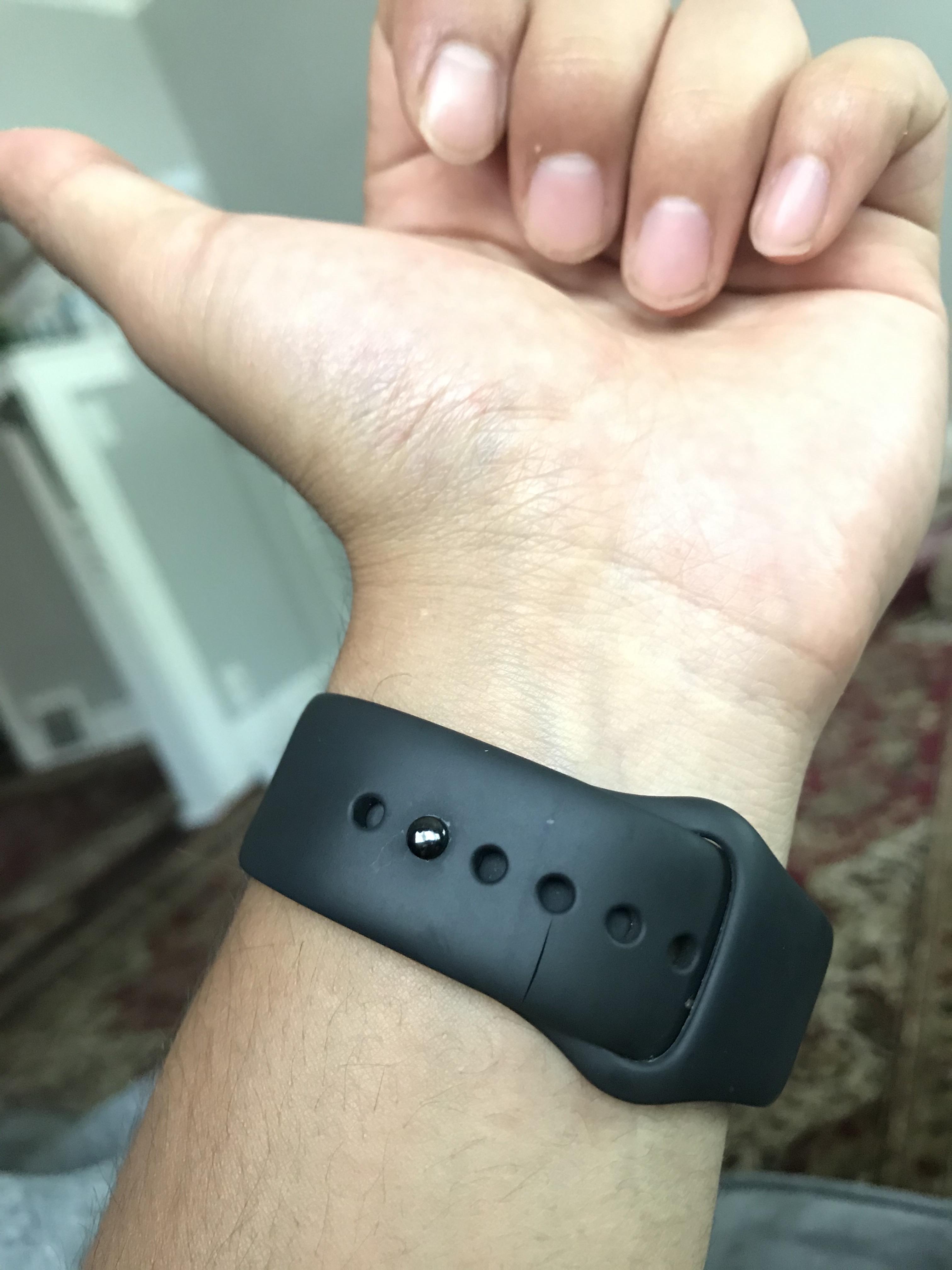 My Apple Watch 4 gen wristband is cracking and it’s not even a year old