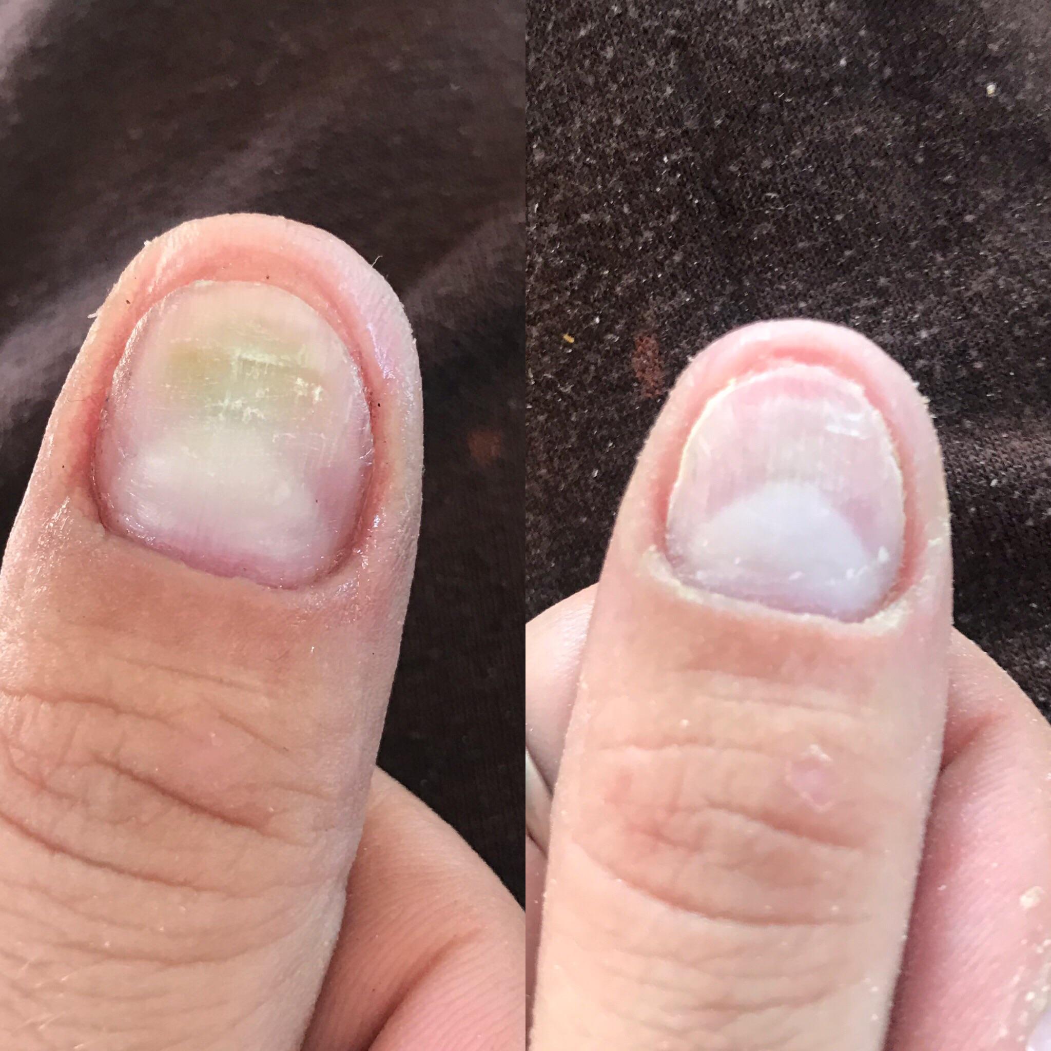 Apple cider vinegar is amazing!! r/RedditLaqueristas