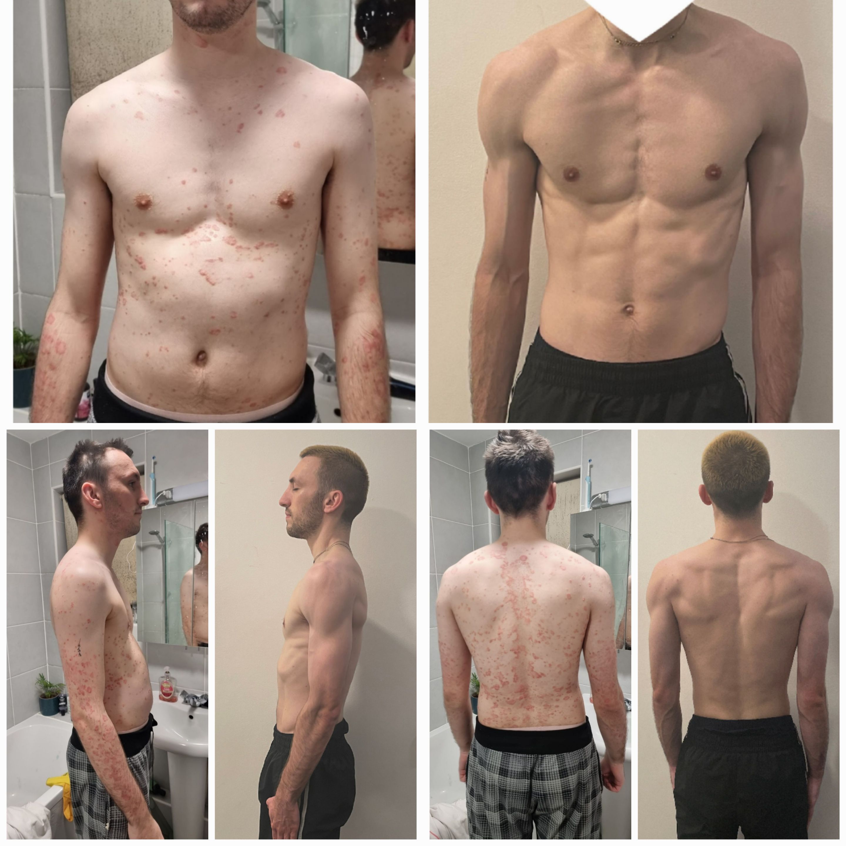 M/26/6ft [175 > 140 = 351bs] (One Year) feel like a different human