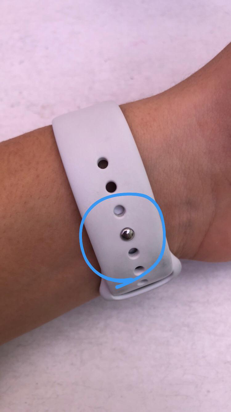 Itchy wrist after wearing the Apple Watch Sport Band r/AppleWatch