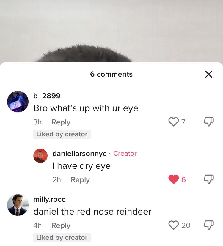 Dry eye r/Daniellarson