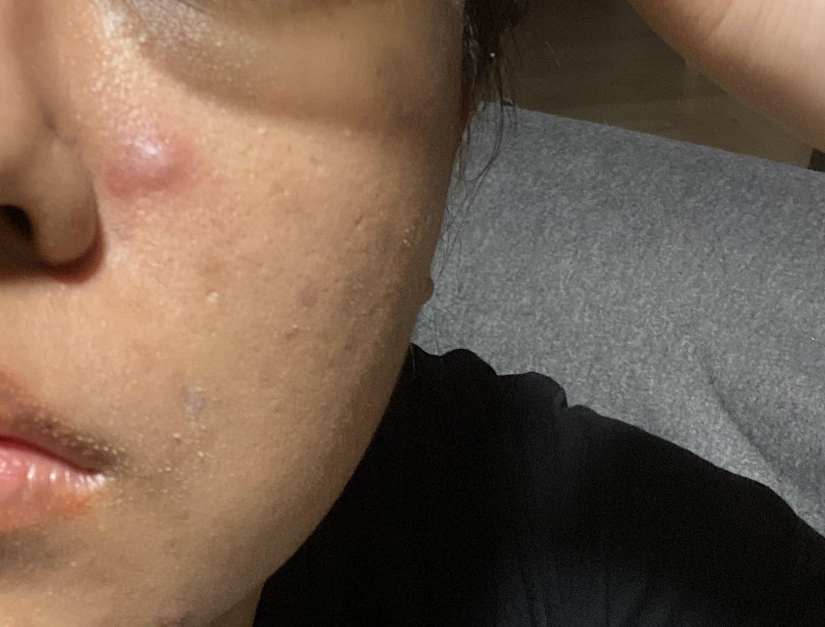 Not sure what this bump is? It starts hard, when squeezed it has no