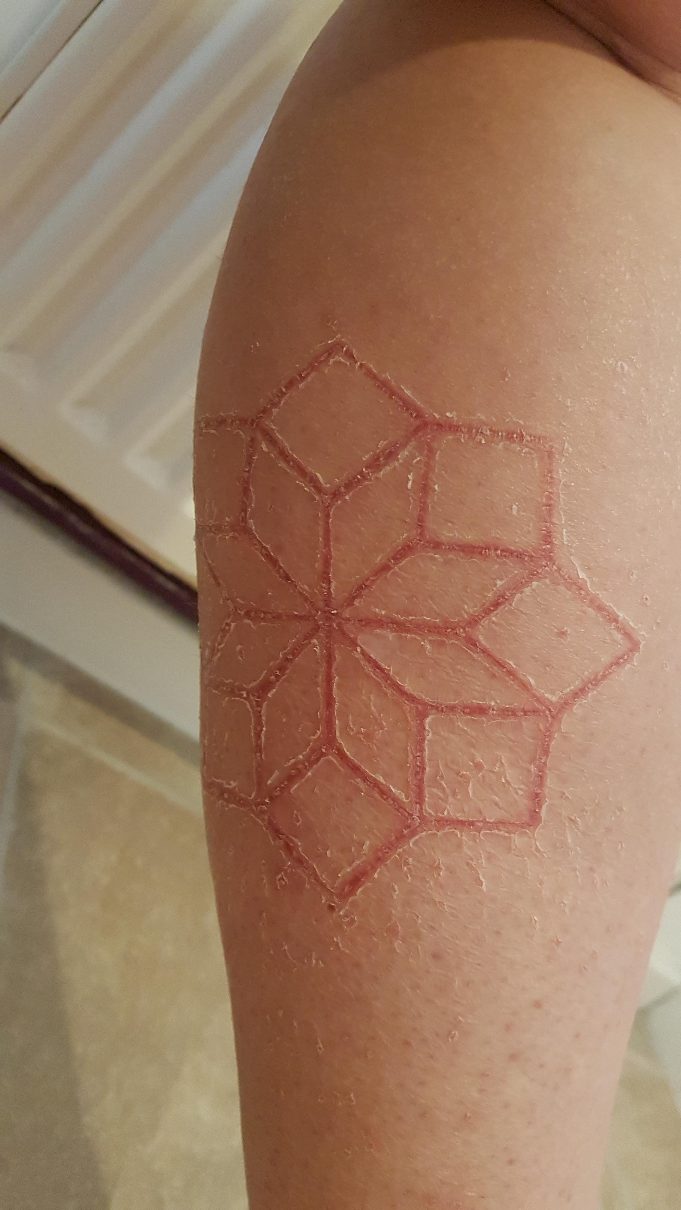 You might appreciate this my calf scarification after two weeks