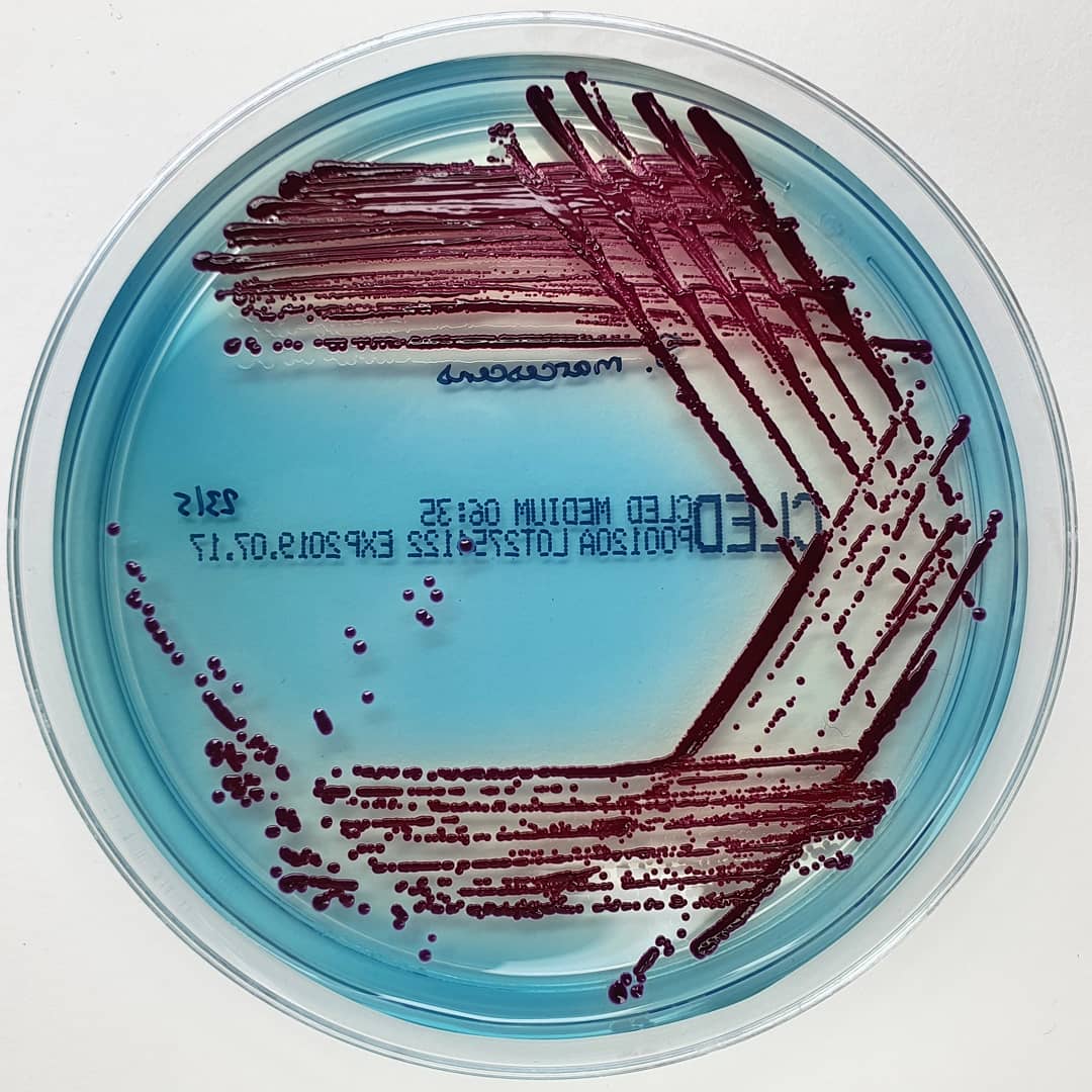 Serratia marcescens on CLED r/microbiology