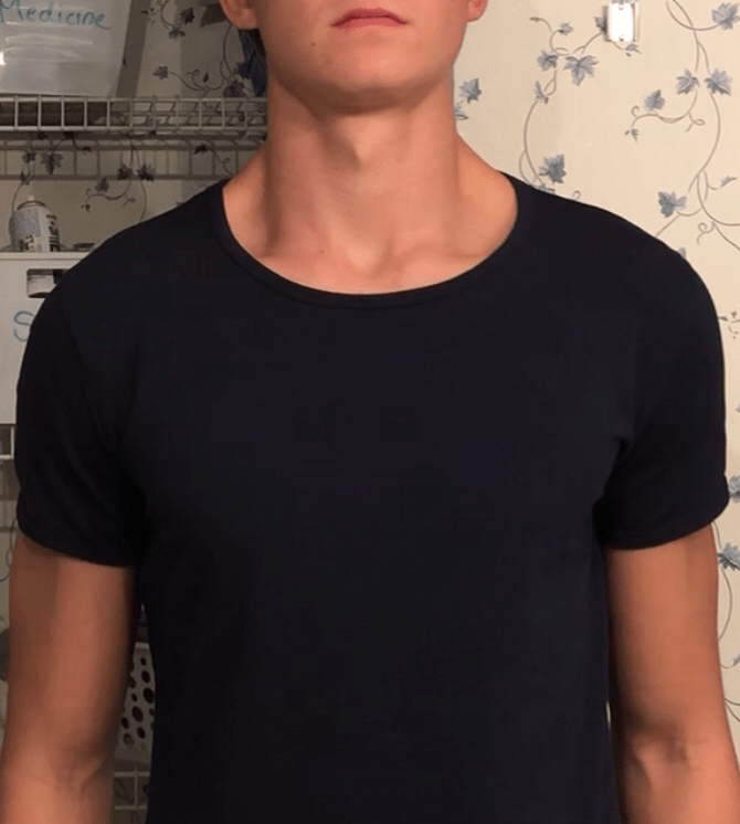 Is this neck hole too big?