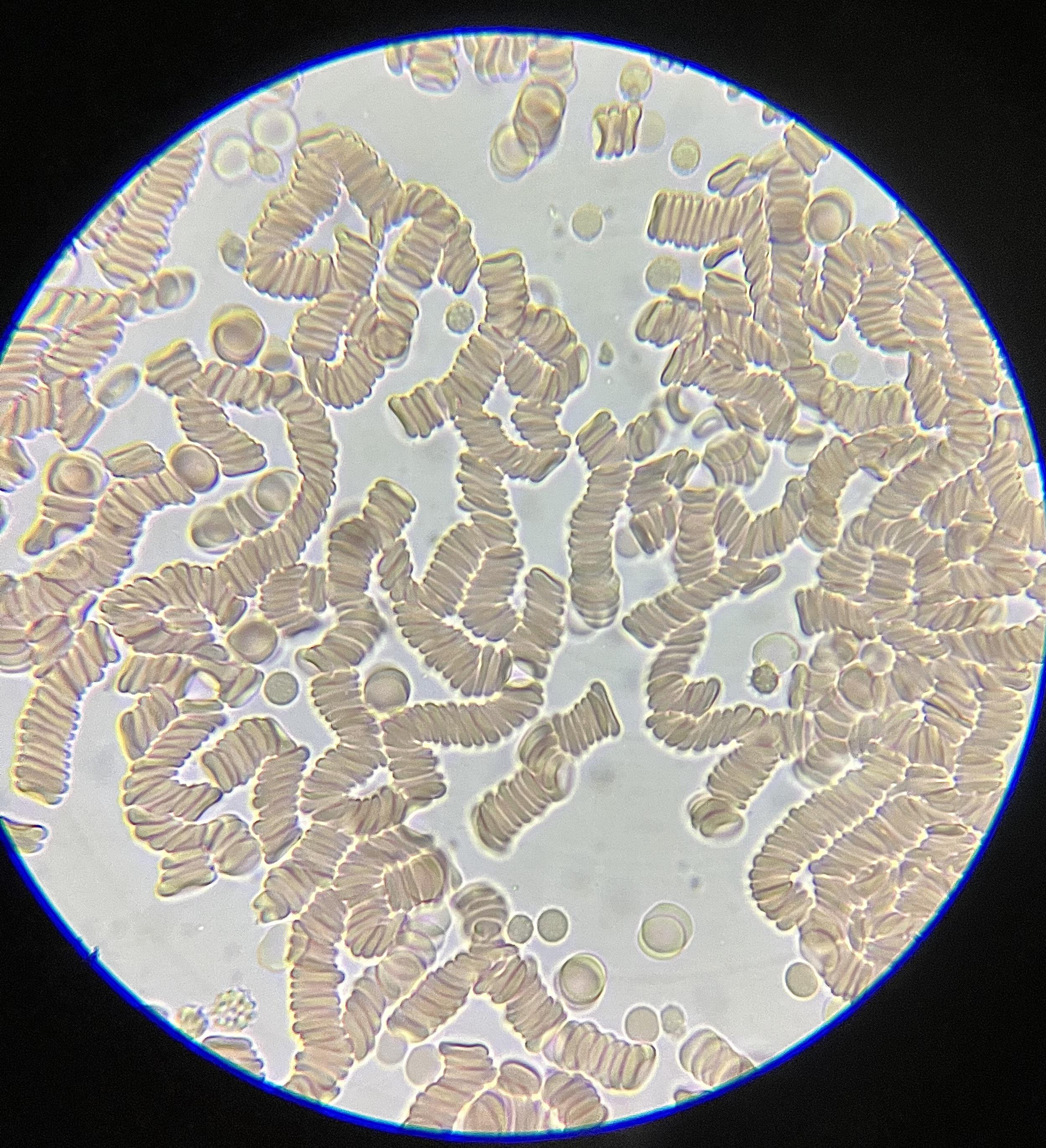 Are these red blood cells normal? Blood taken from fresh wound. Friend