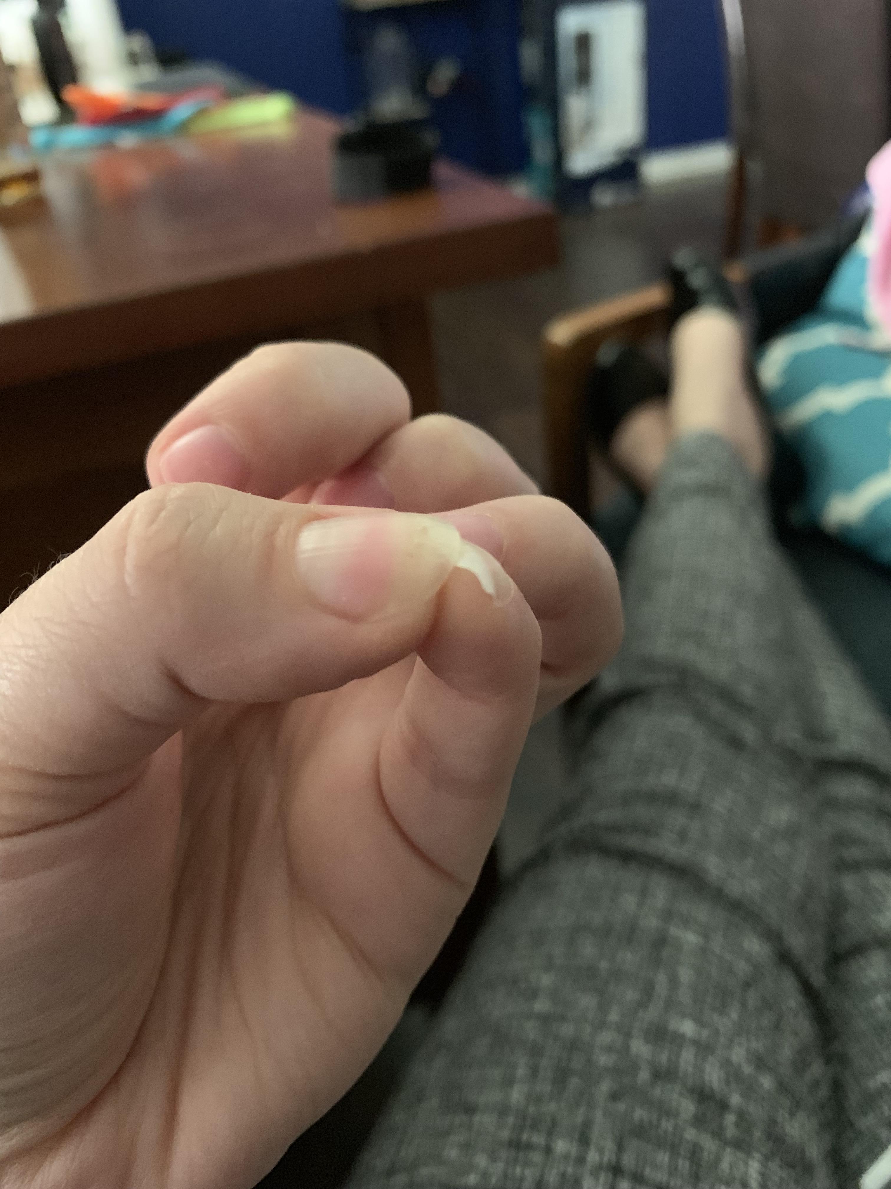 My nails are really weak. I don’t use gel, acrylic or anything like