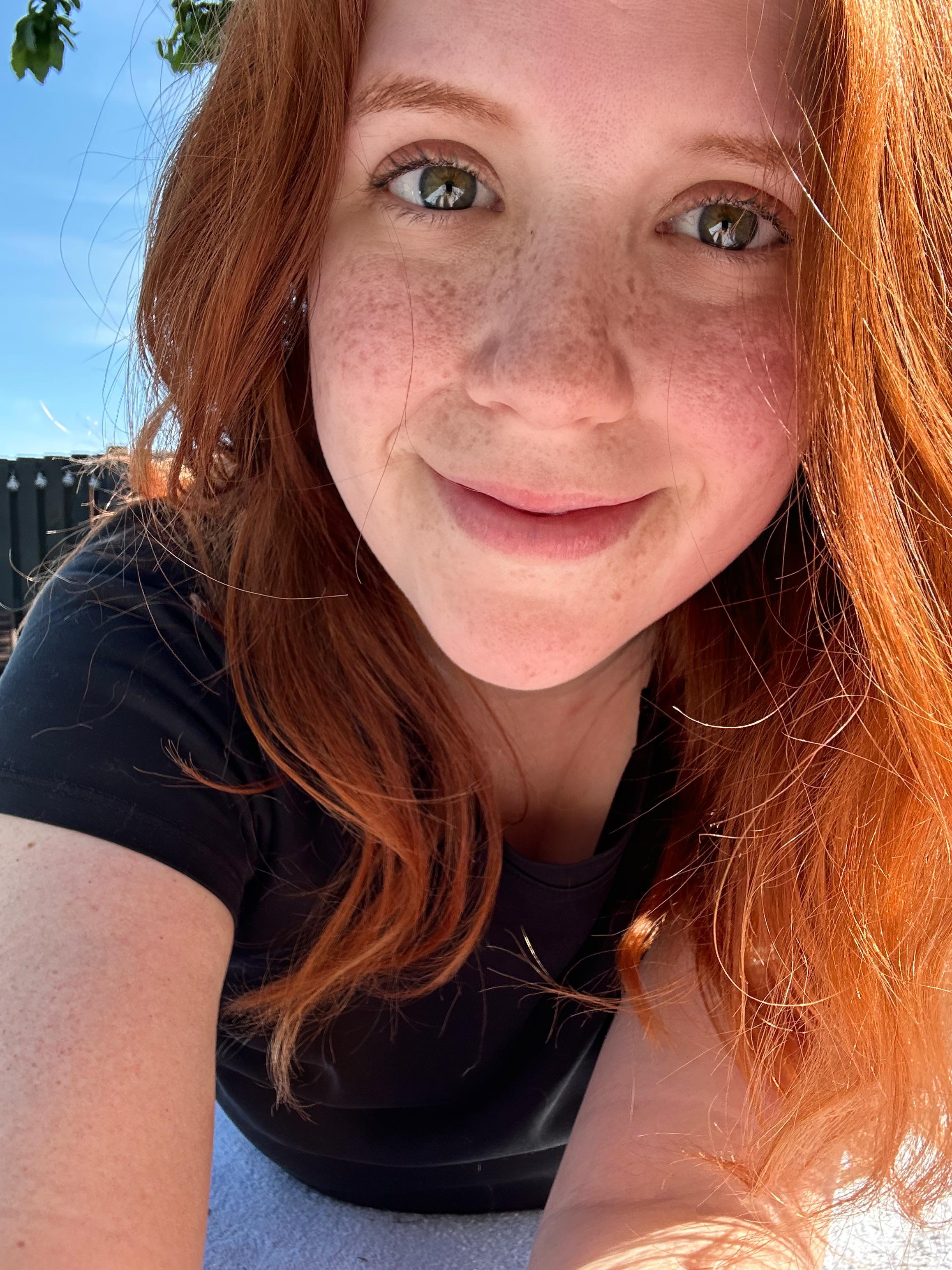 I’d like to thank the Scottish sun for all these freckles! : r