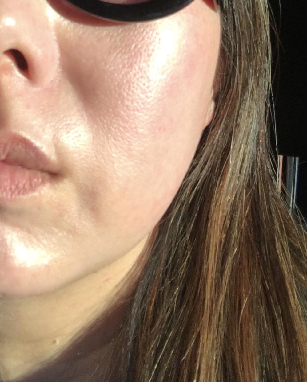 [skin concerns] what can I do for this orange peel like texture? r