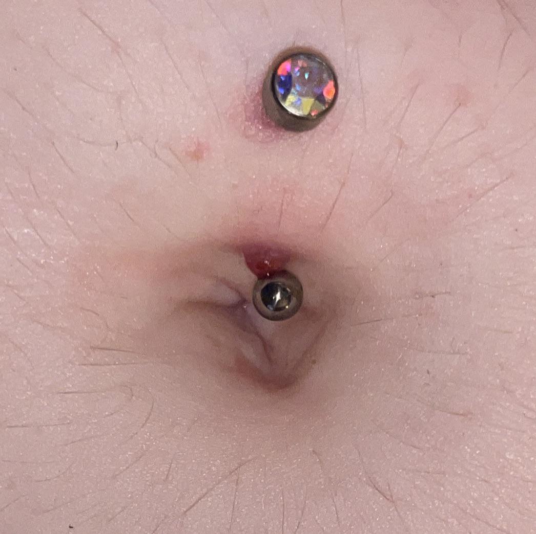 I think my navel piercing is infected. Can I take it out? Is this even an infection? r/piercing