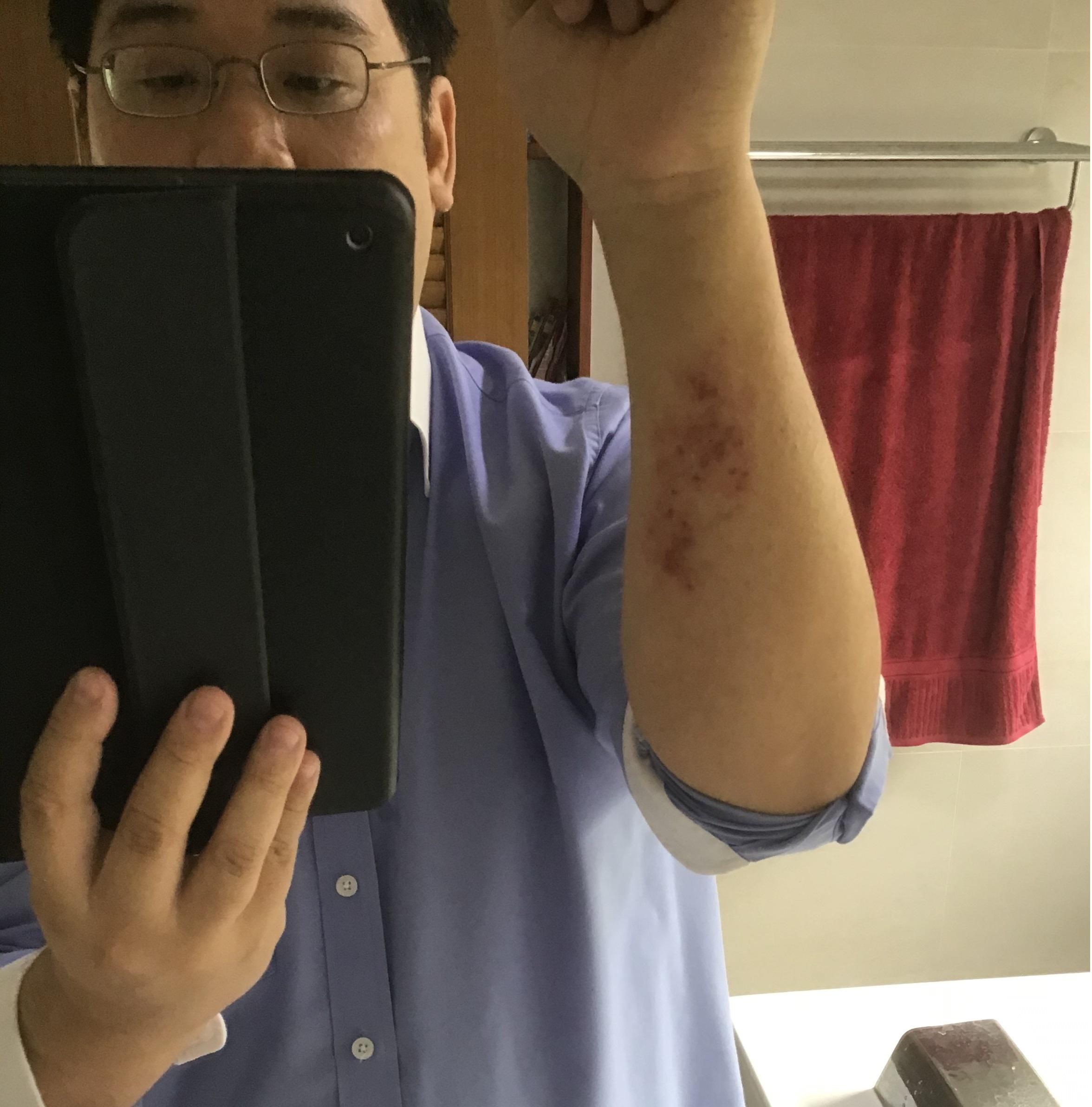 Everyone, please take your DLP Resin safety protocol and handling