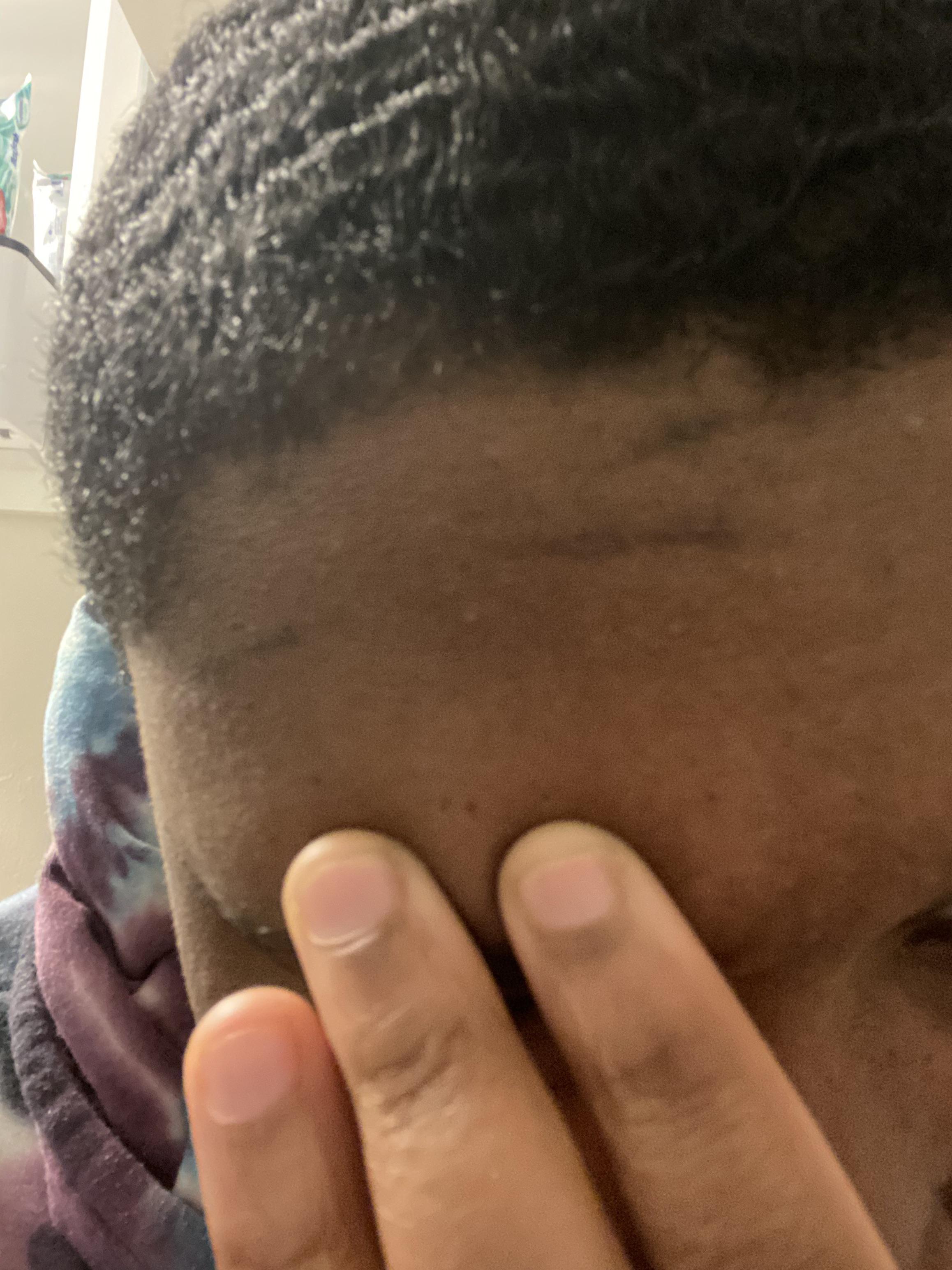 How to get rid of lines? It’s from wearing my durag too tight r/360Waves