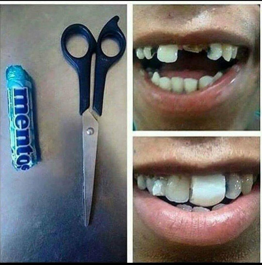 Thanks, I hate mentos and teeth TIHI