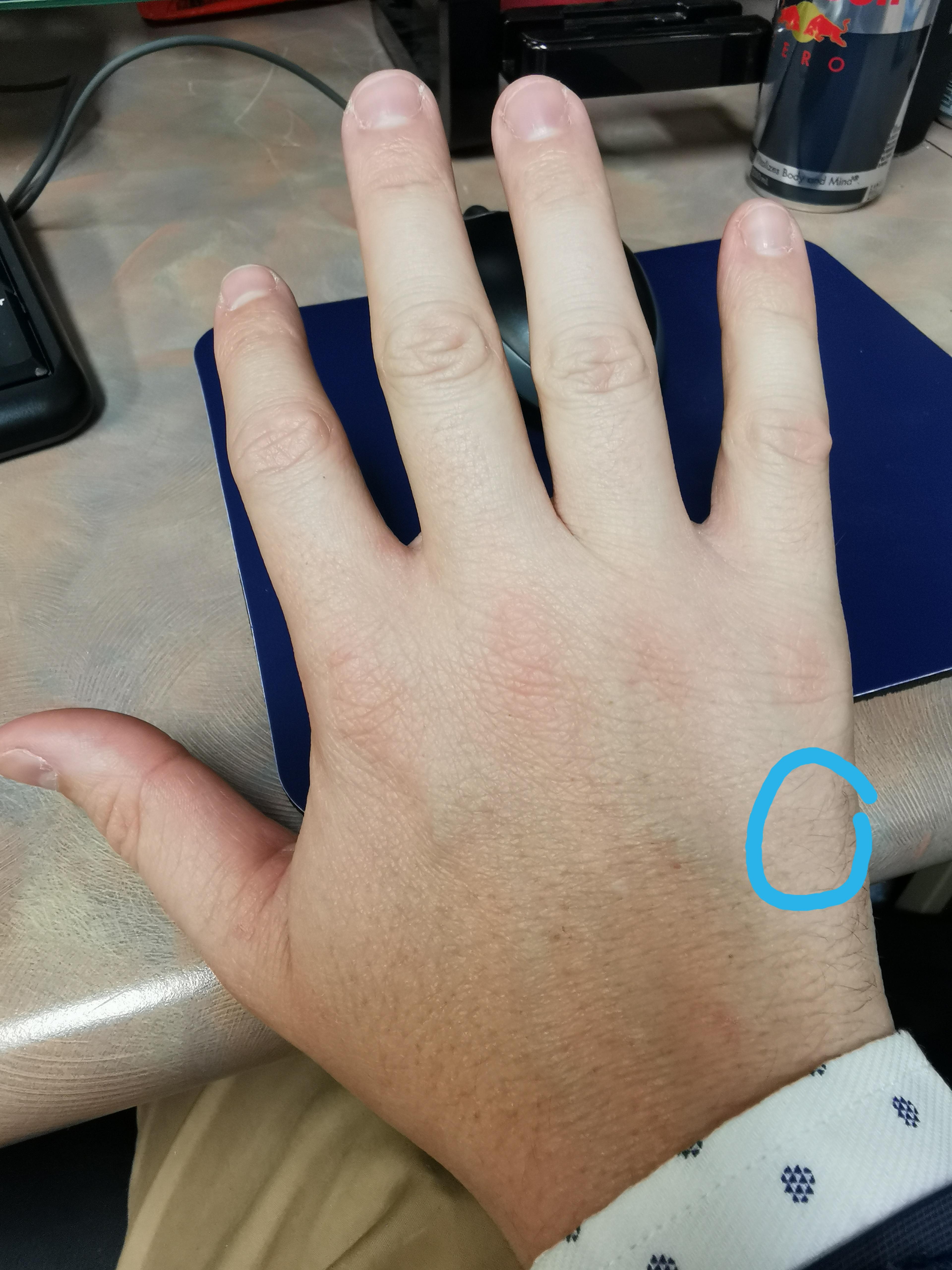 Noticed a sharp pain here when bending my wrist back after playing 18